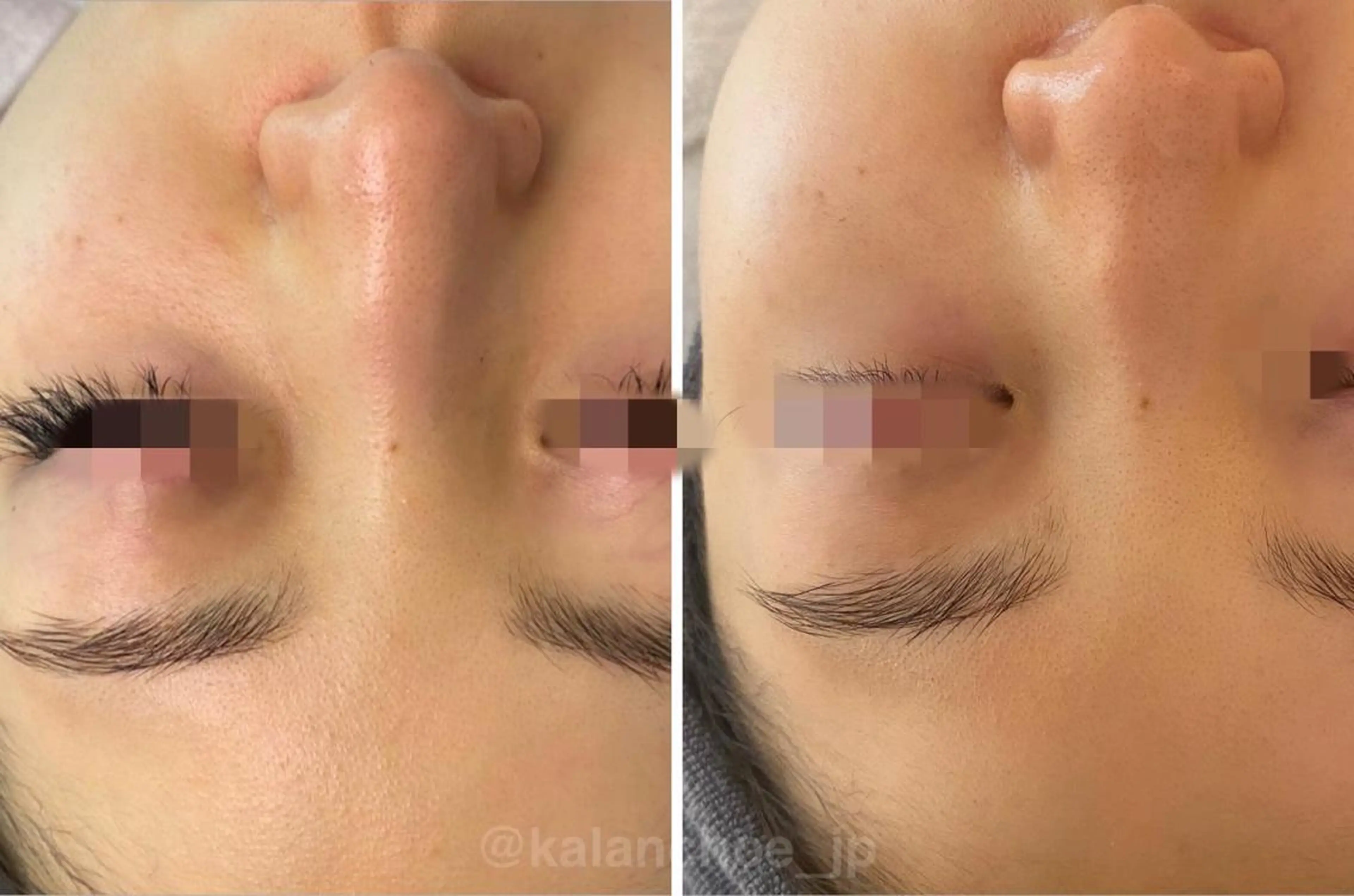 エステ 肌質改善 KALANCHOEのエステ・リラクイメージ