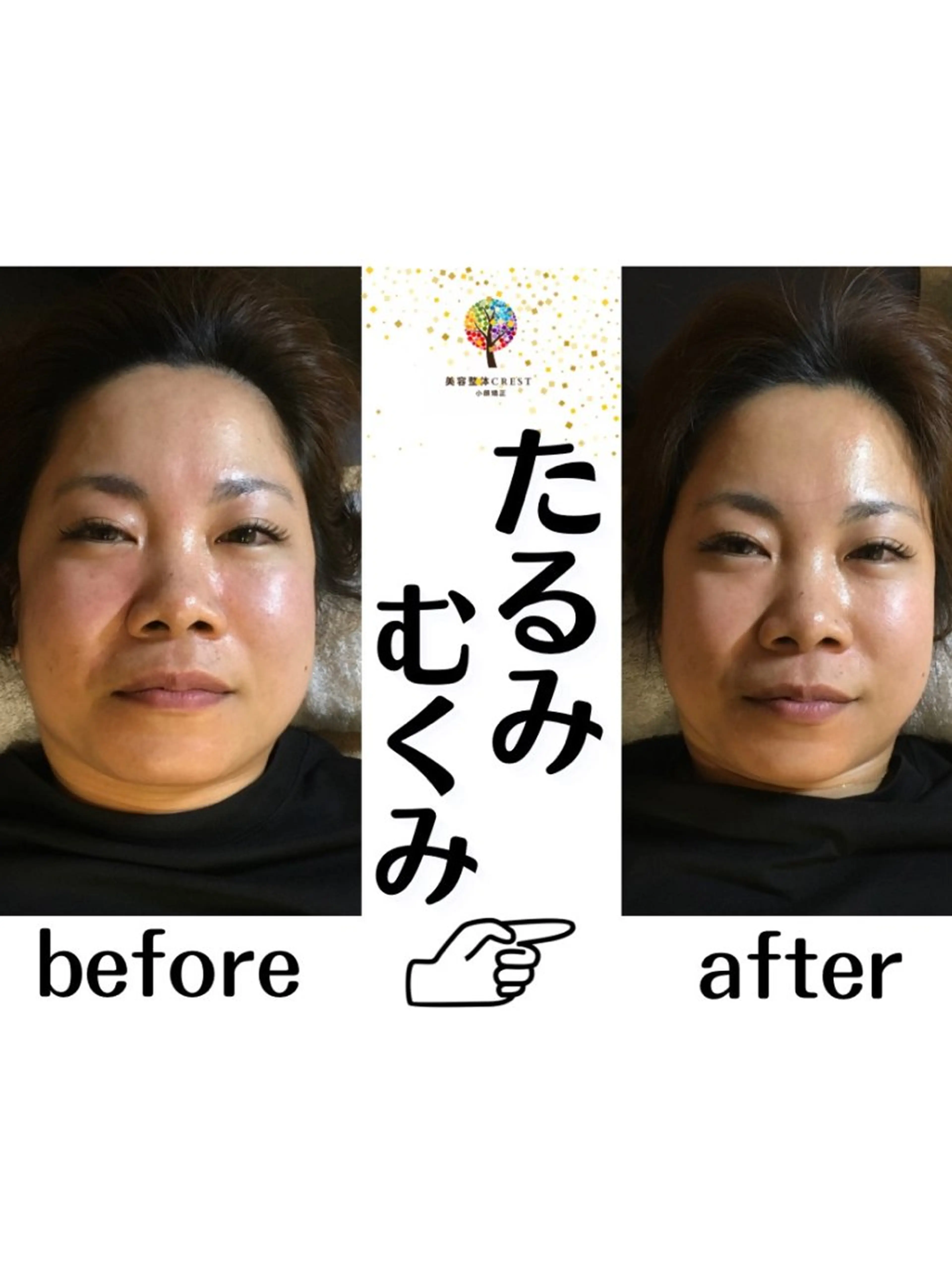 【”塗るだけで小顔実感“】小顔フェイシャル×ゼロジーフリー◎30分→¥1,980の写真