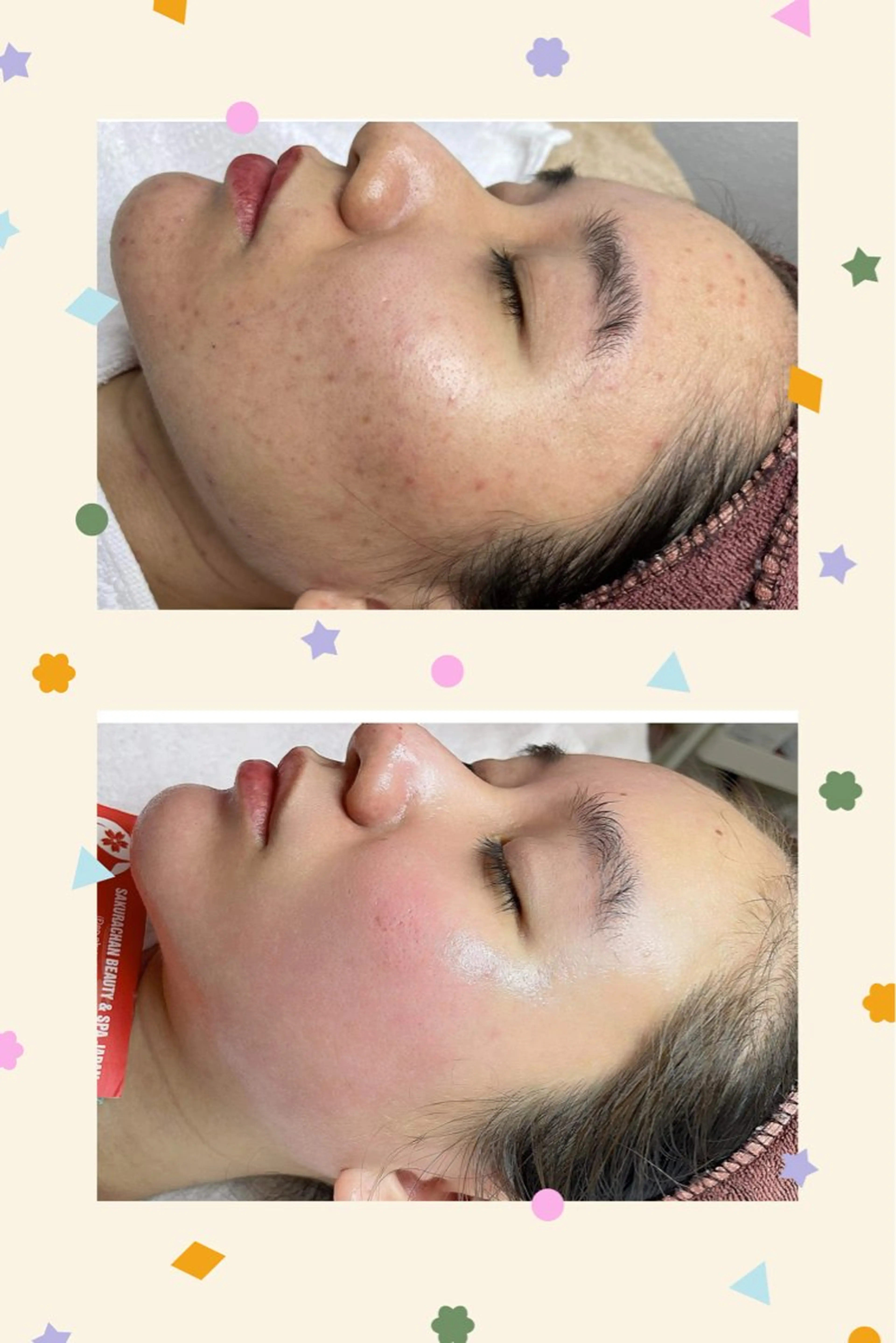 ニキビ、痩身、脱毛、 サクラチャンスパのエステ・リラクイメージ