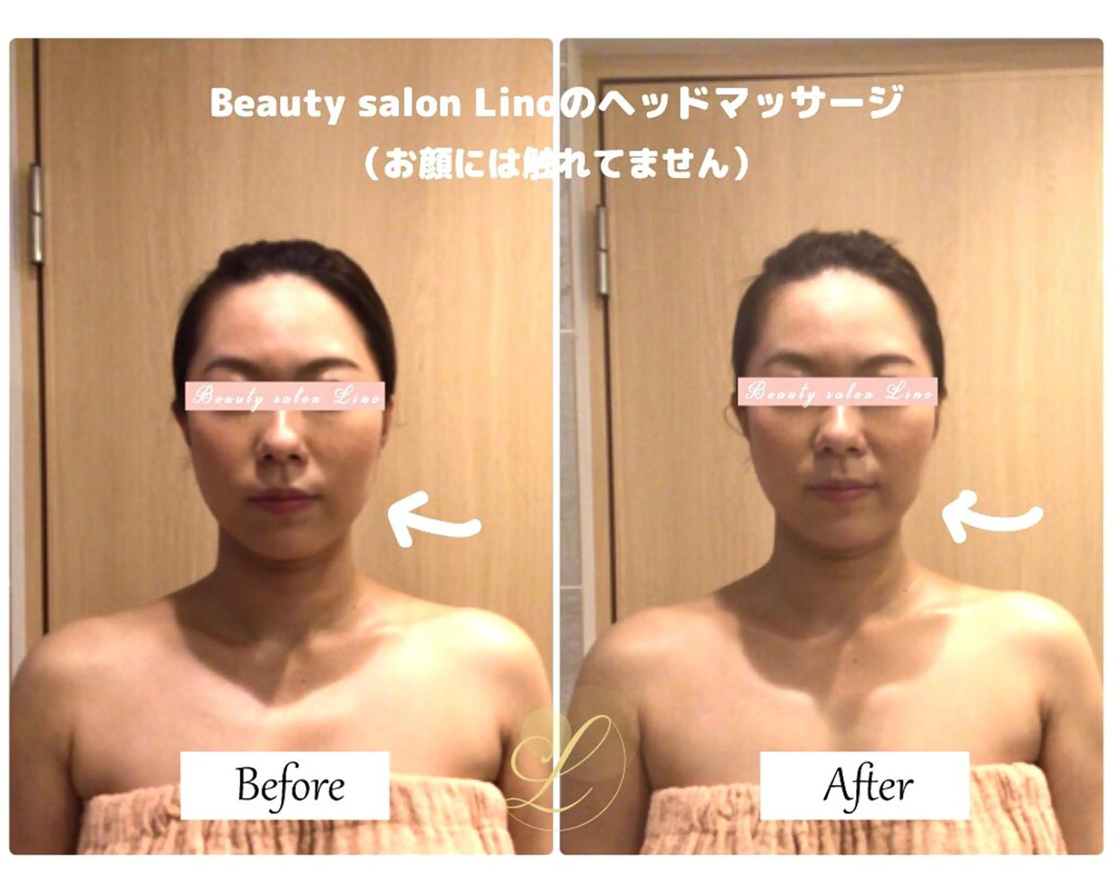 痩身×フェイシャル ブライダル|Linoのエステ・リラクイメージ