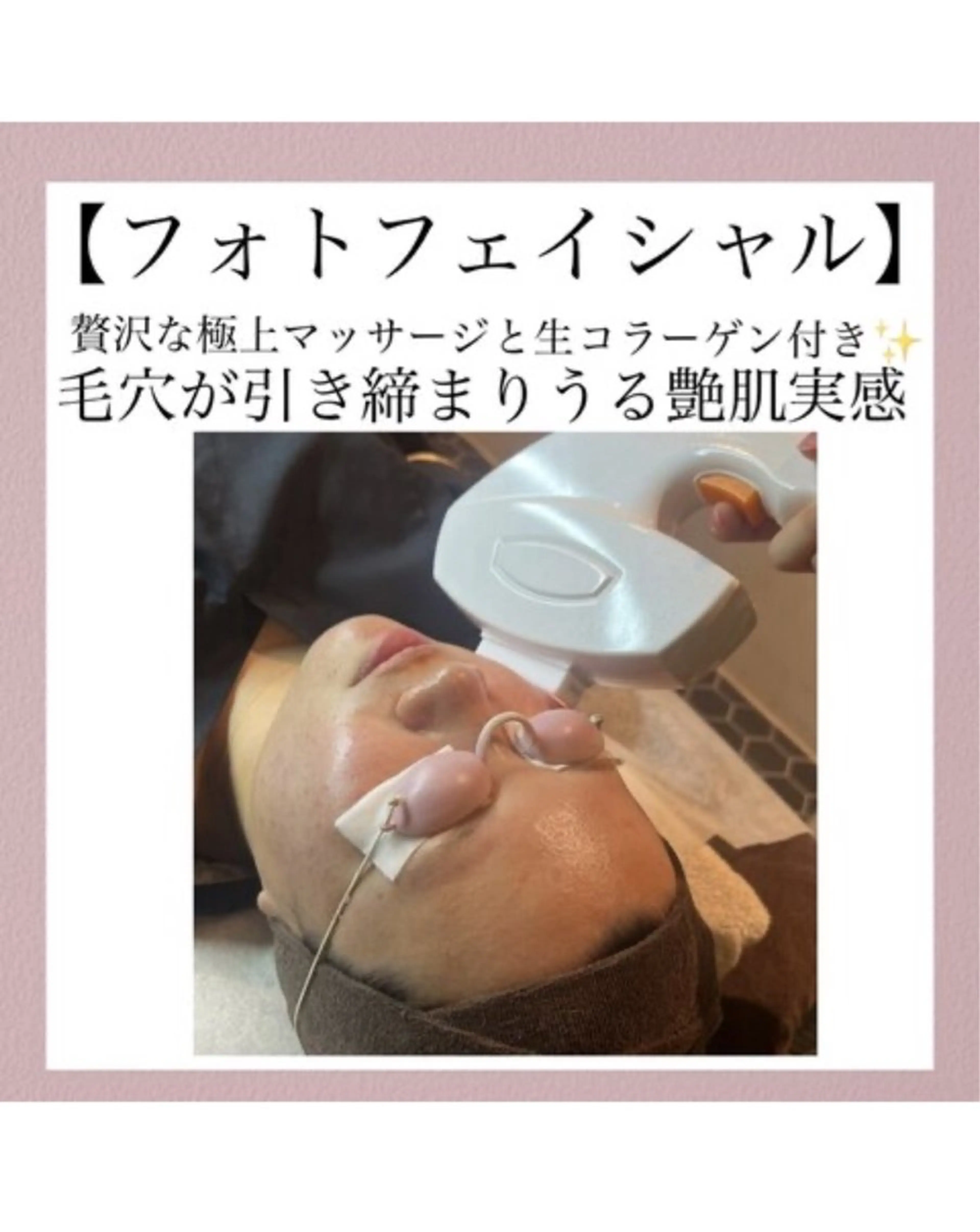 光エステ（コラーゲンパック付き）💆🏻✨の写真