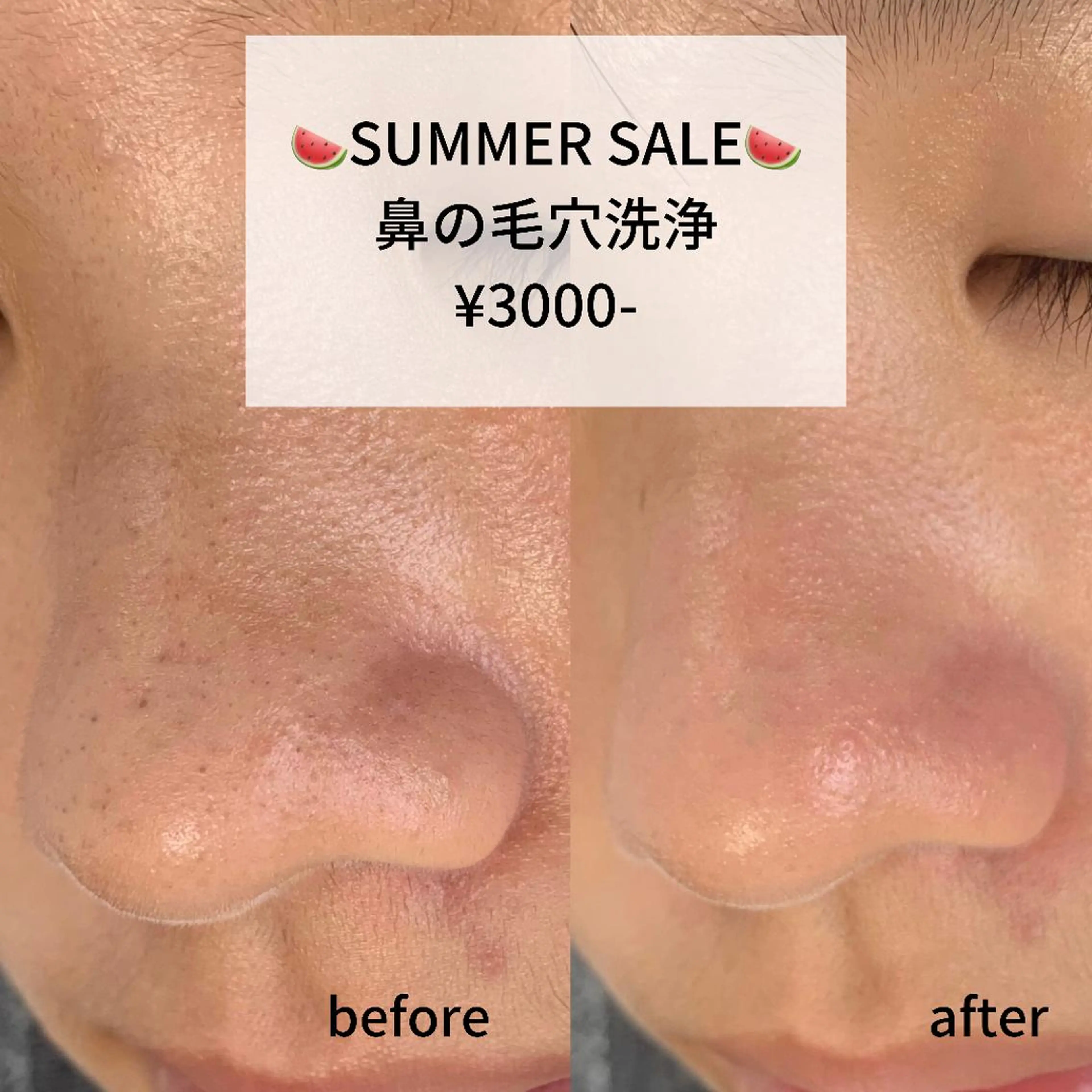 エステ salonLADYSTYLE所属・稲嶺 美華のエステ・リラクイメージ