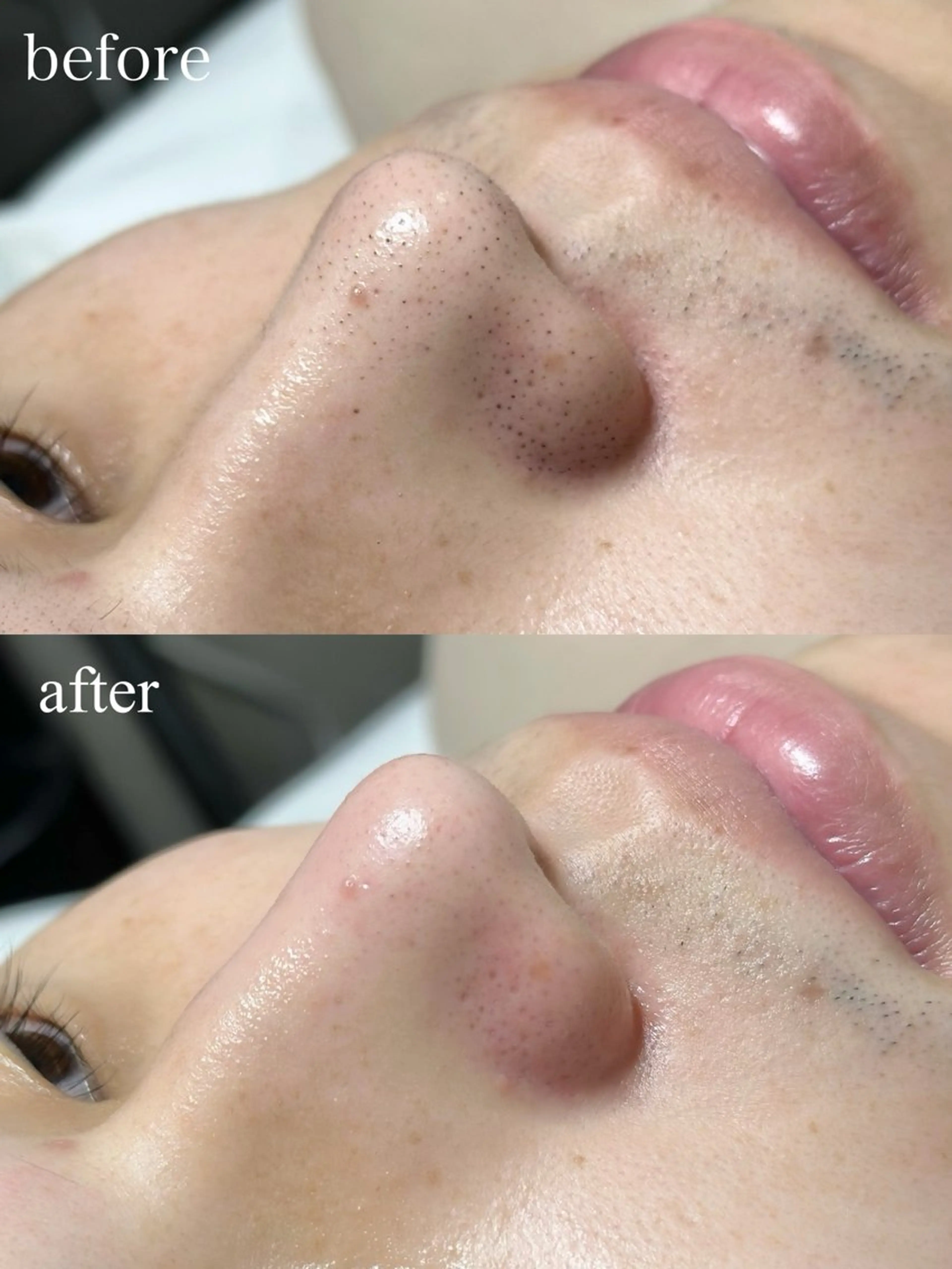 《💆🏻ツルツル美顔💆🏻》美眉アイブロウWAX＋フルフェイス 保湿+眉仕上げ込の写真