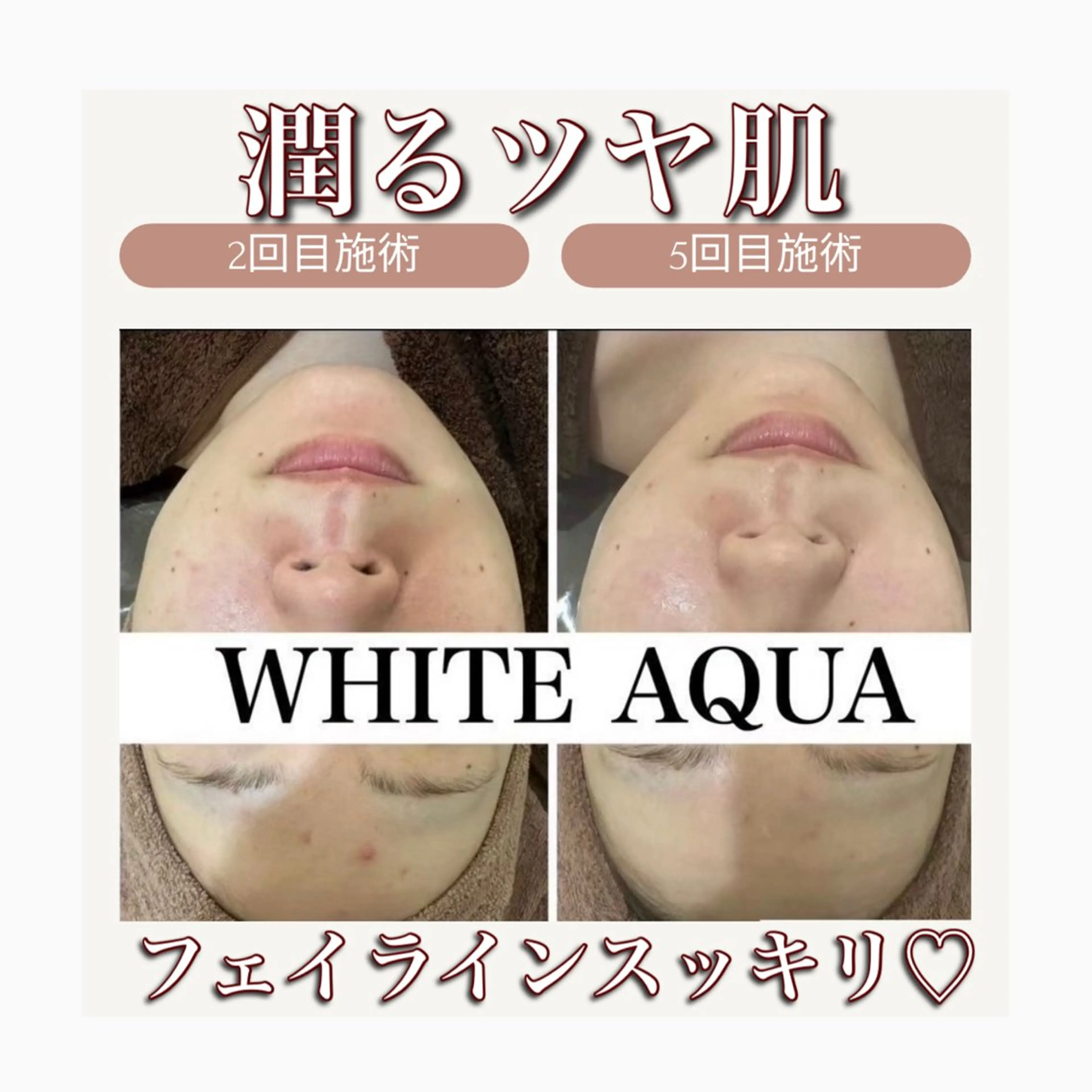 White Aqua 福岡博多店のエステ・リラクイメージ
