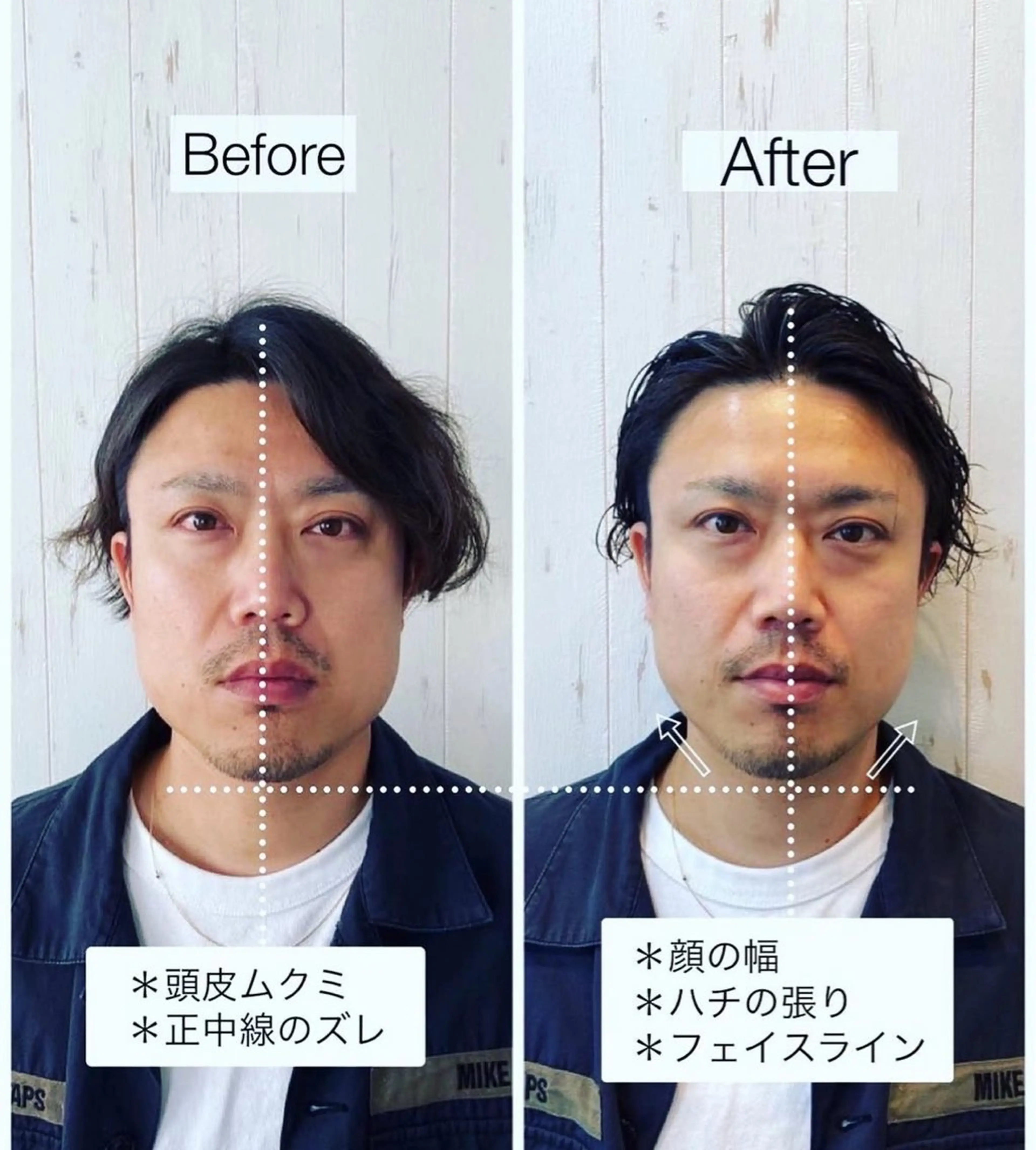 ✤モニター様限定✤ 骨格補正スパ+トリートメントの写真