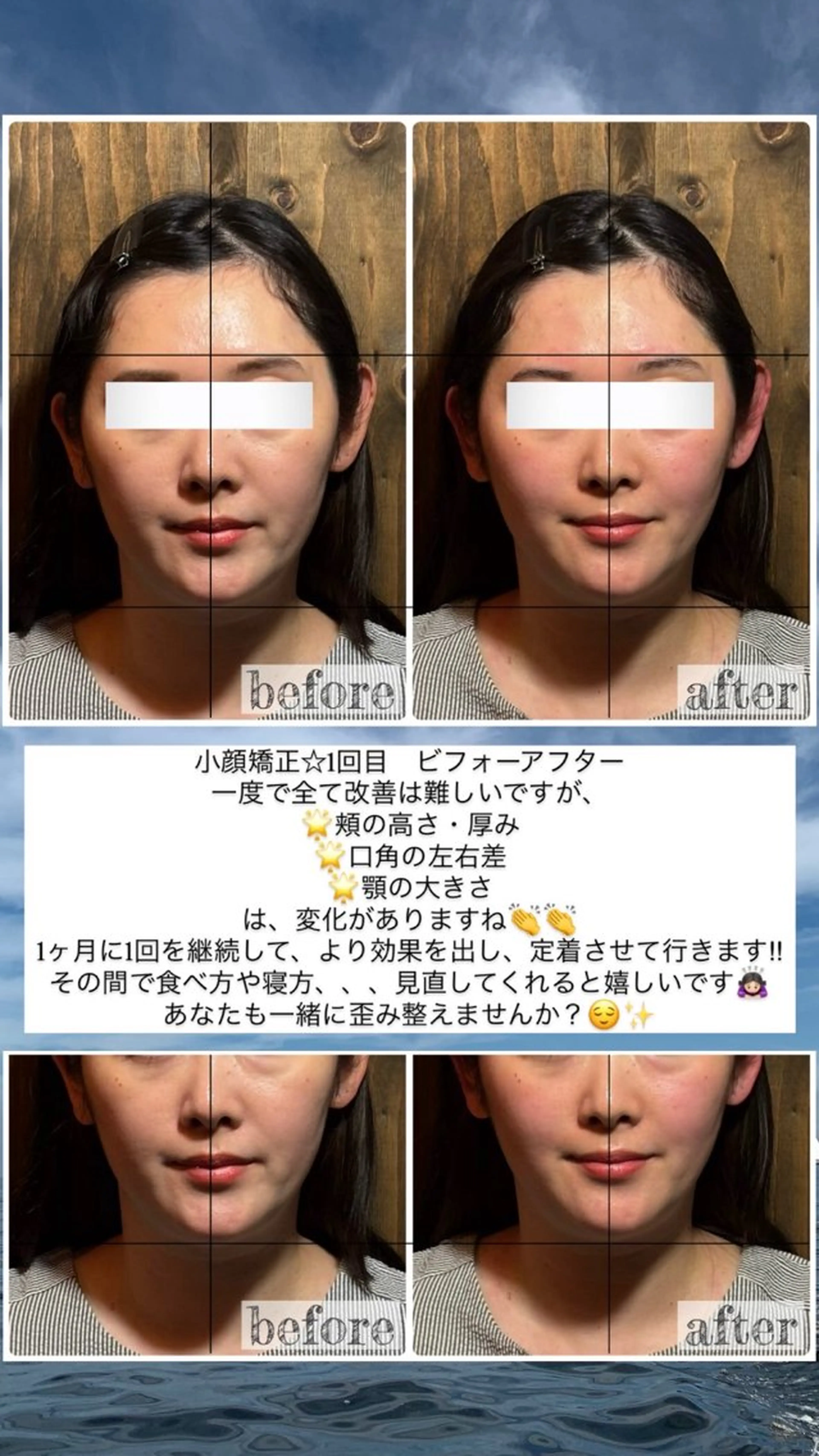 エステ リラク 💎後悔させない小顔 矯正💎イトヤマ🌱のエステ・リラクイメージ