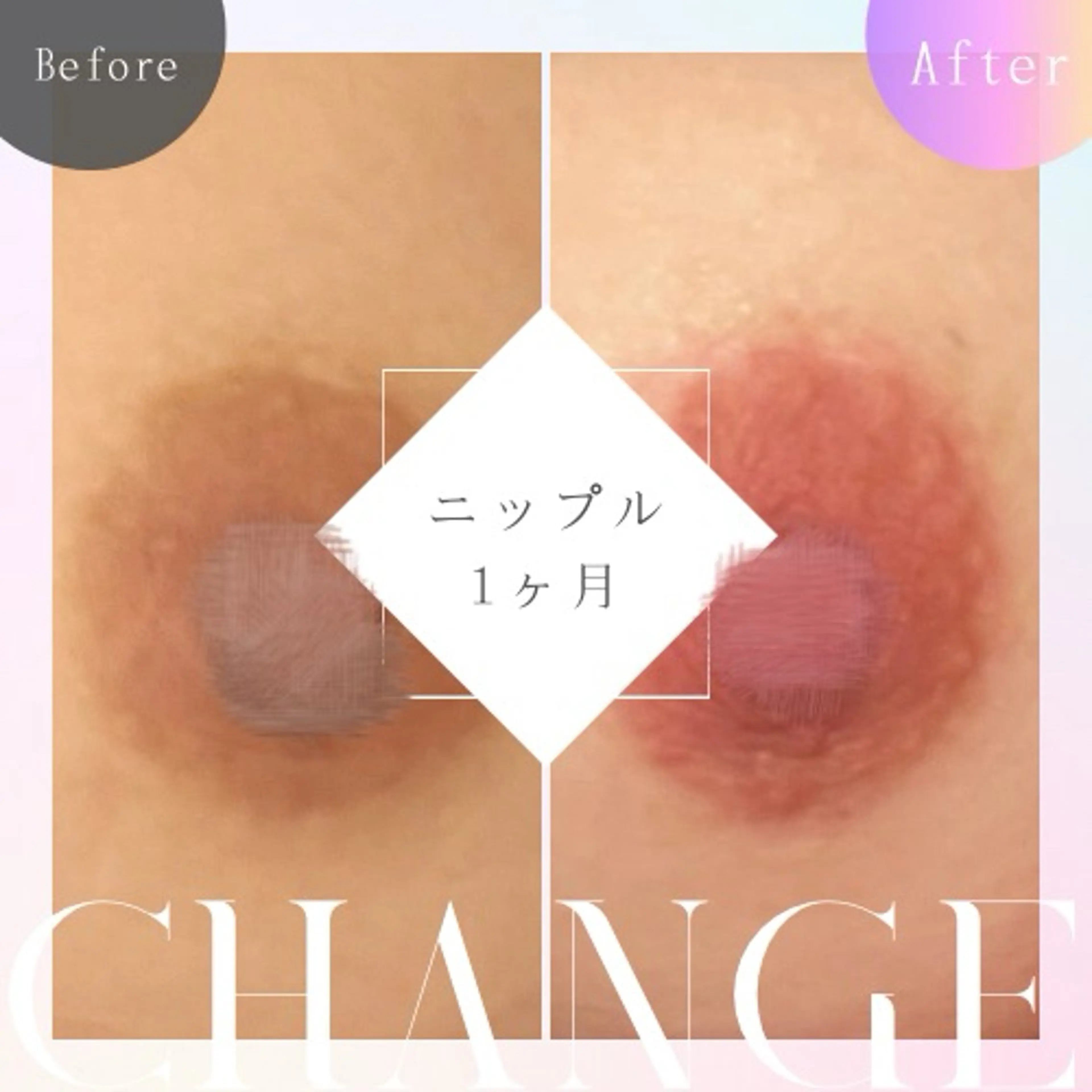 ローマピンク（ニップル🟰乳輪）の写真