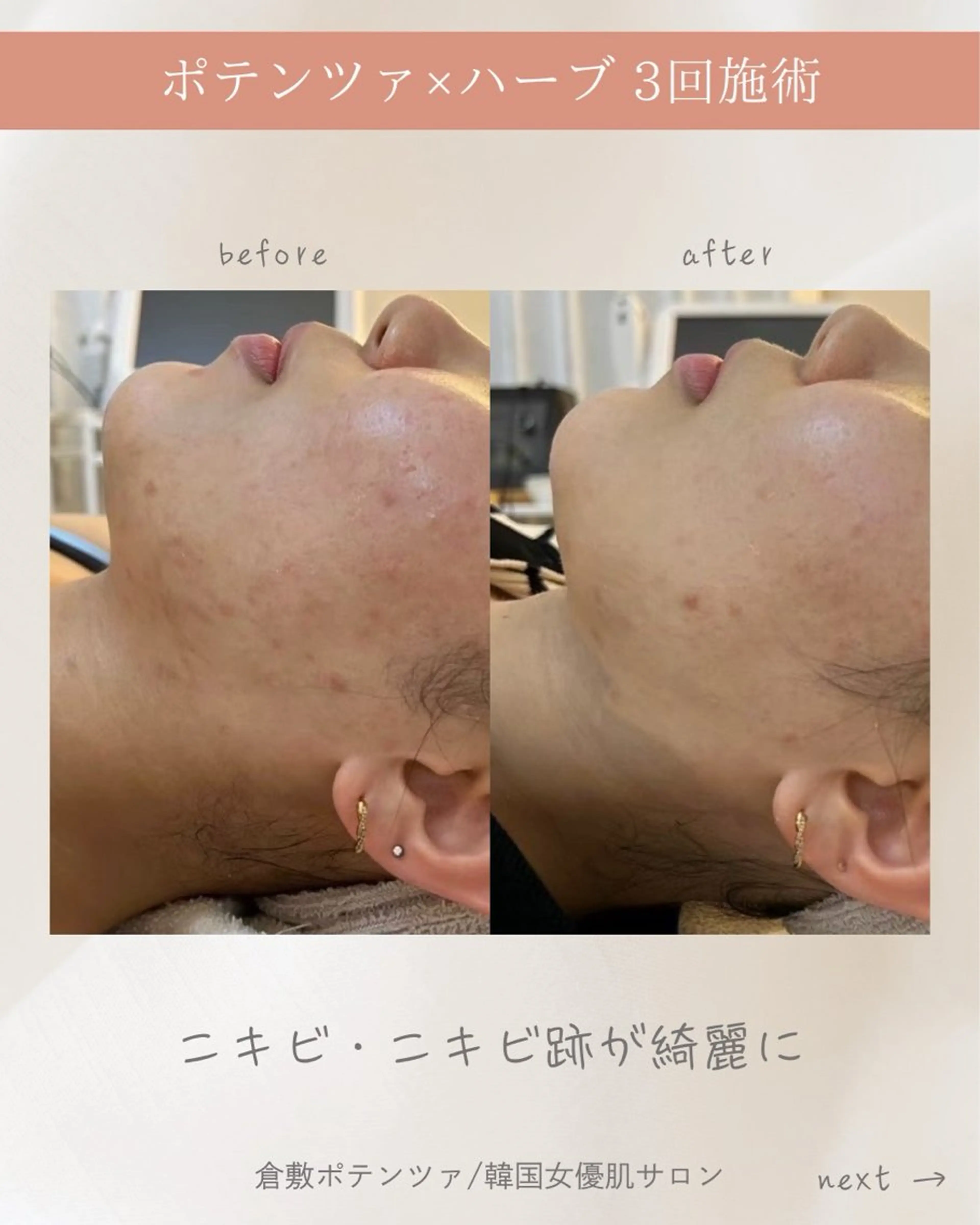 その他 Unfil ｜ちひろのエステ・リラクイメージ
