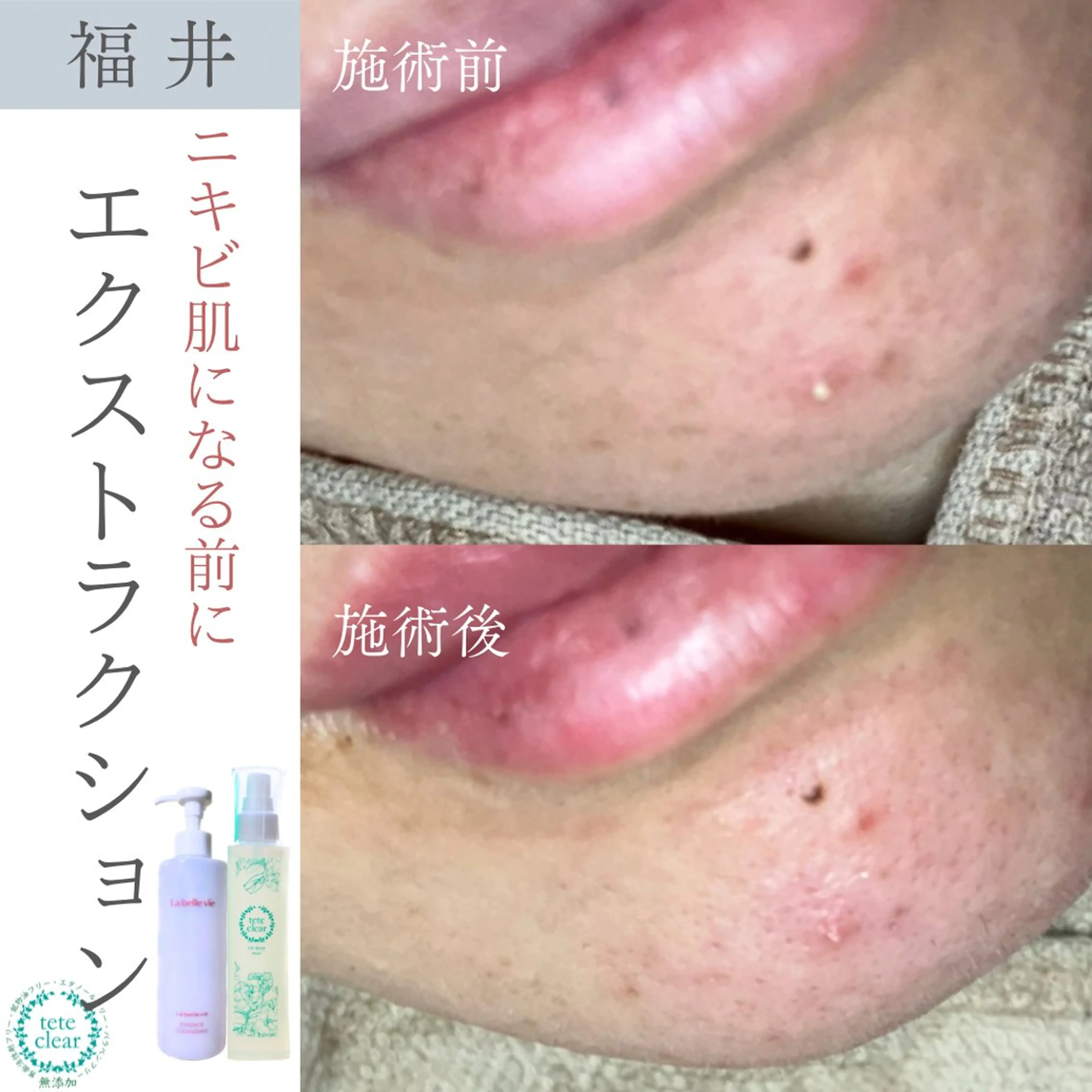 毛穴ケア専門サロン Yourmeユアミーのエステ・リラクイメージ