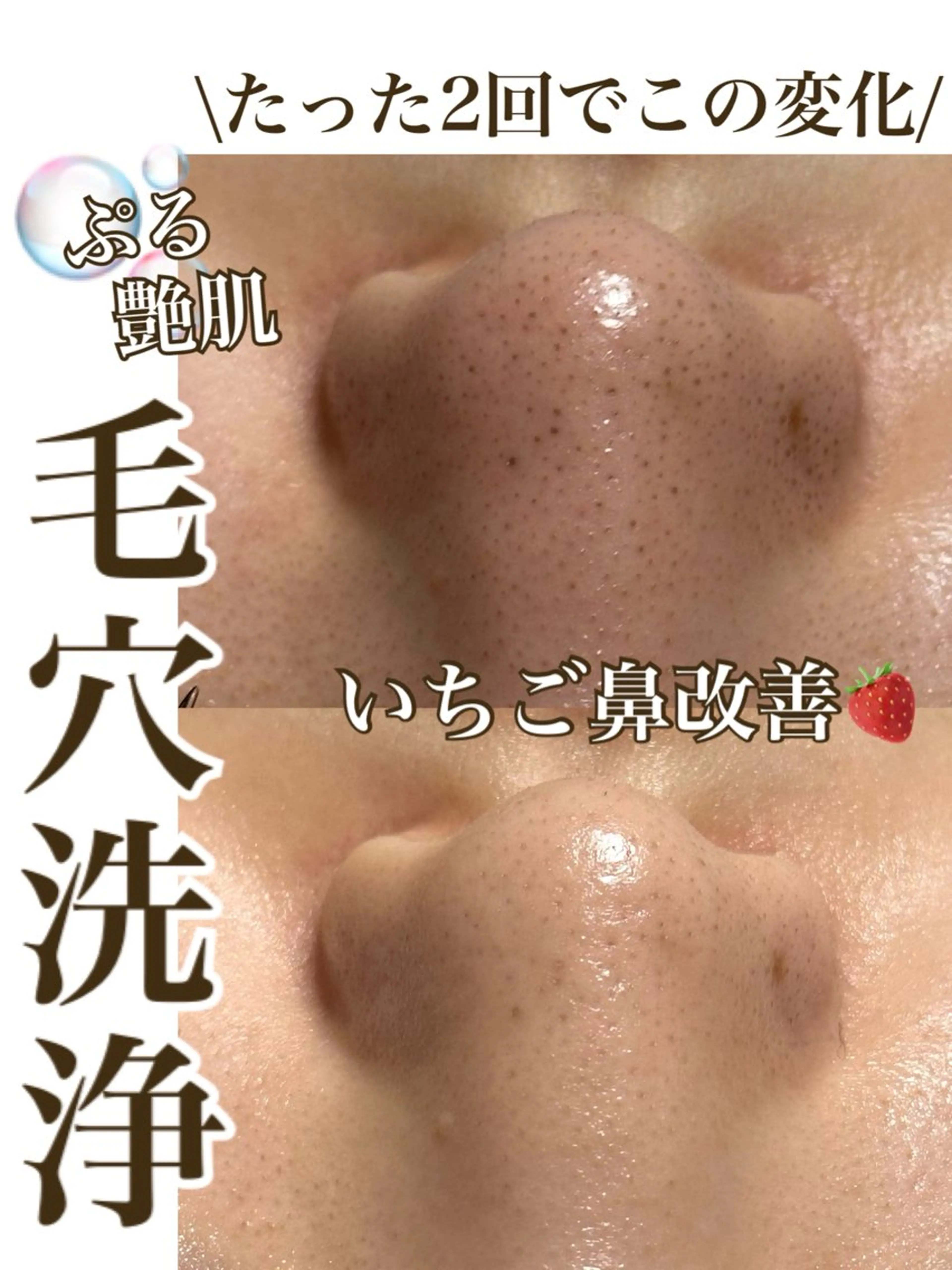 エステ White labo 今村のその他イメージ