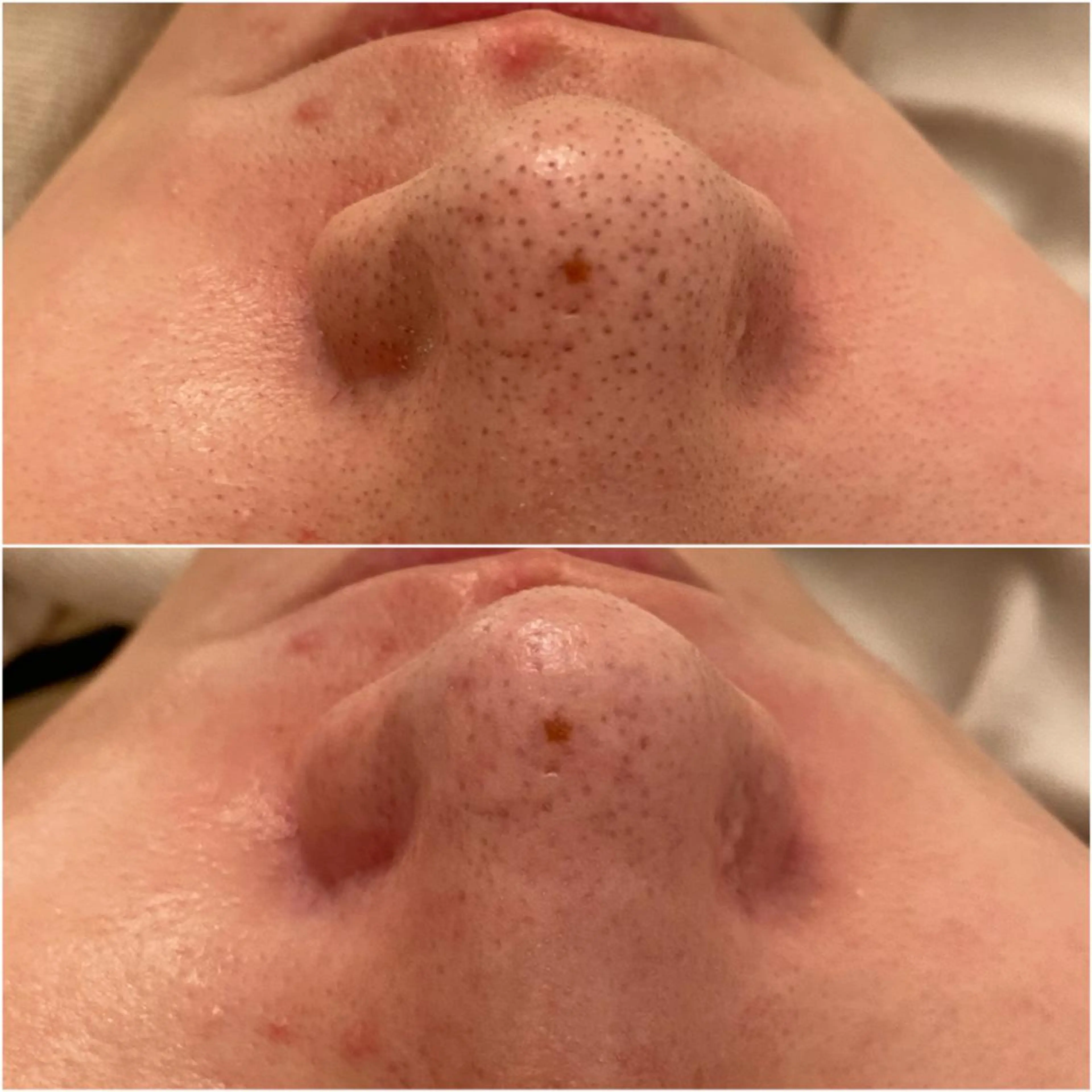 ✨美肌水光✨ アトリエリュバンのエステ・リラクイメージ