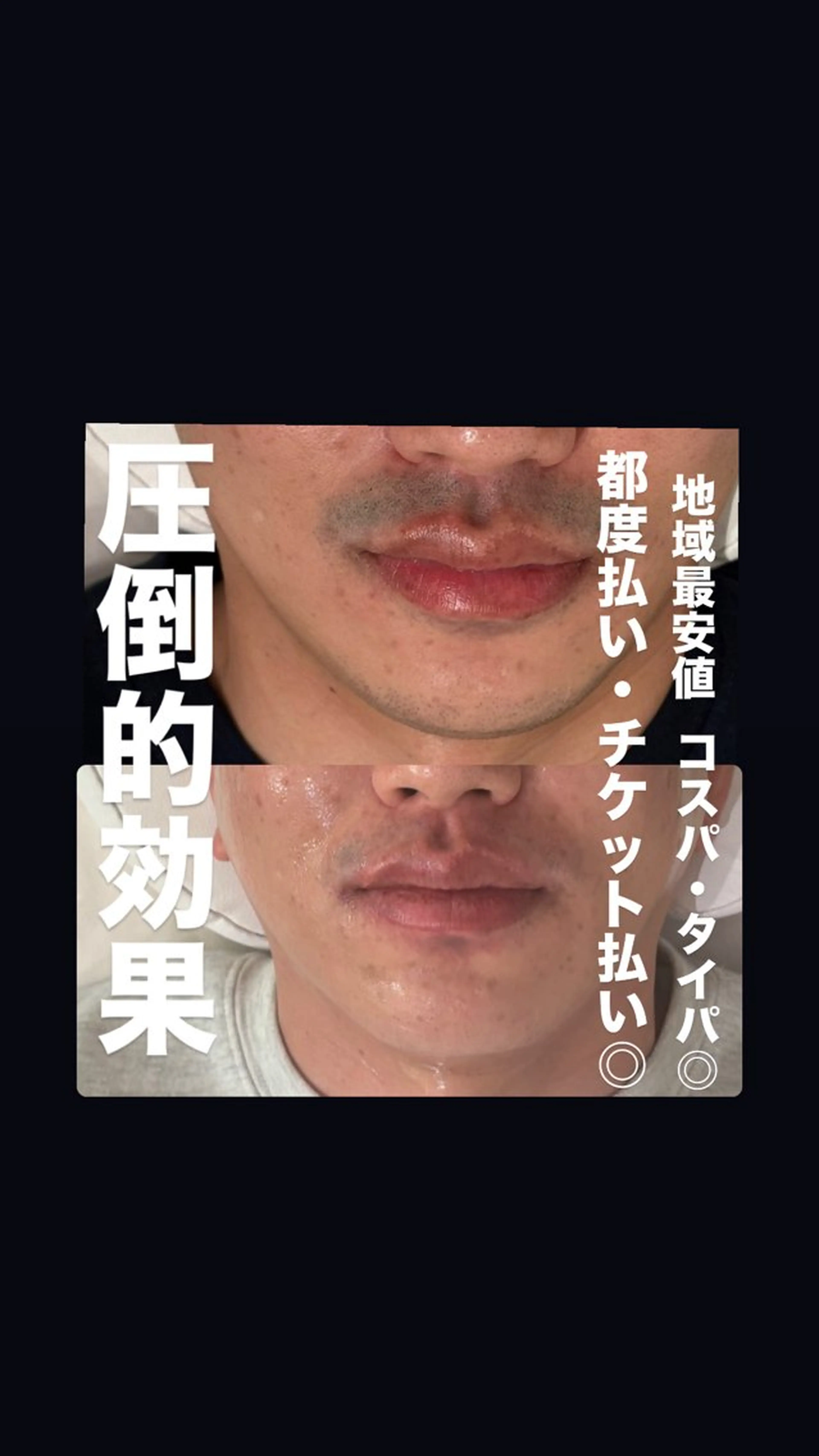 脱毛 beauty salon LUCIALL所属・HBL【眉毛】・脱毛 LUCIALLの眉毛・アイブロウイメージ