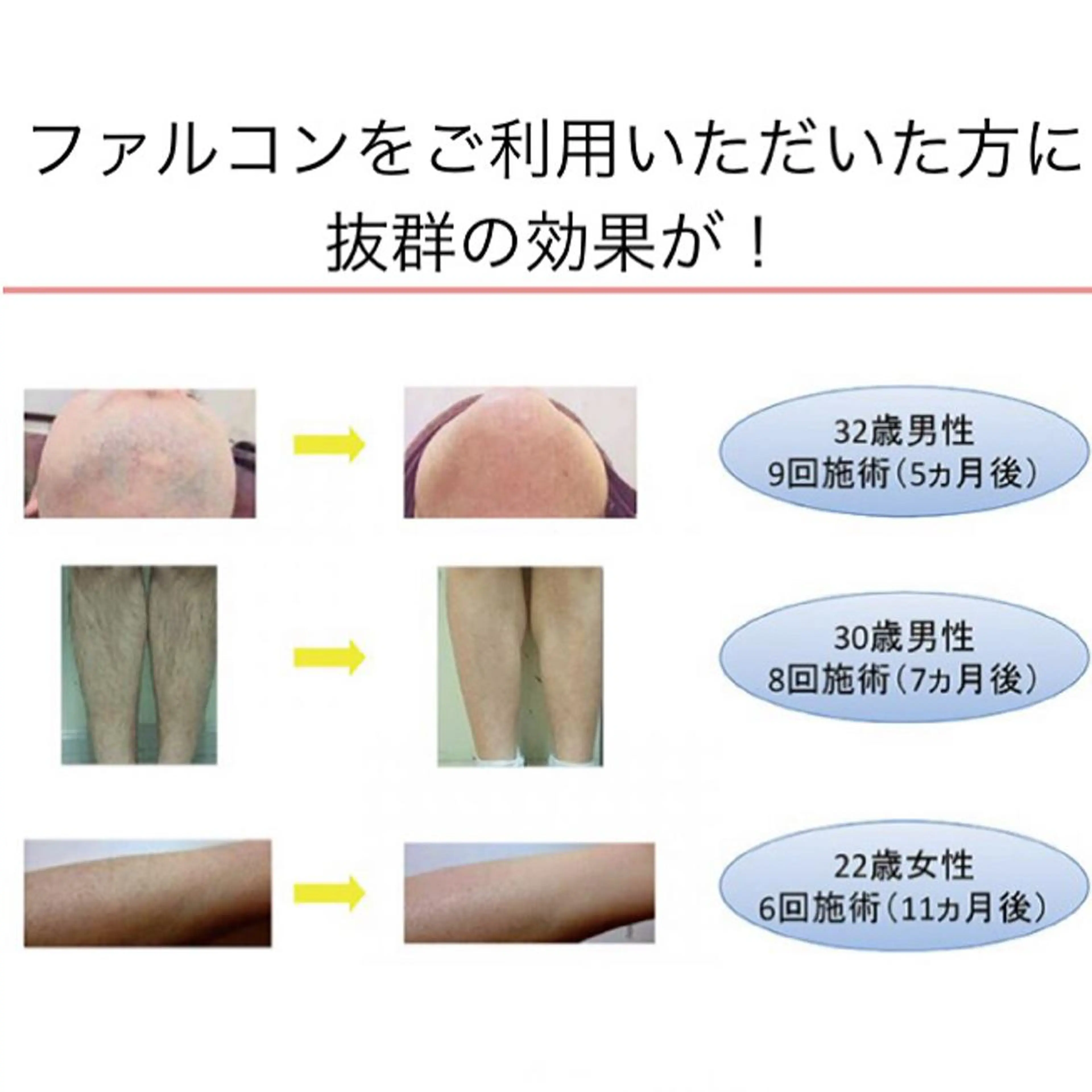髙尾 綺女のマツエク・マツパデザイン