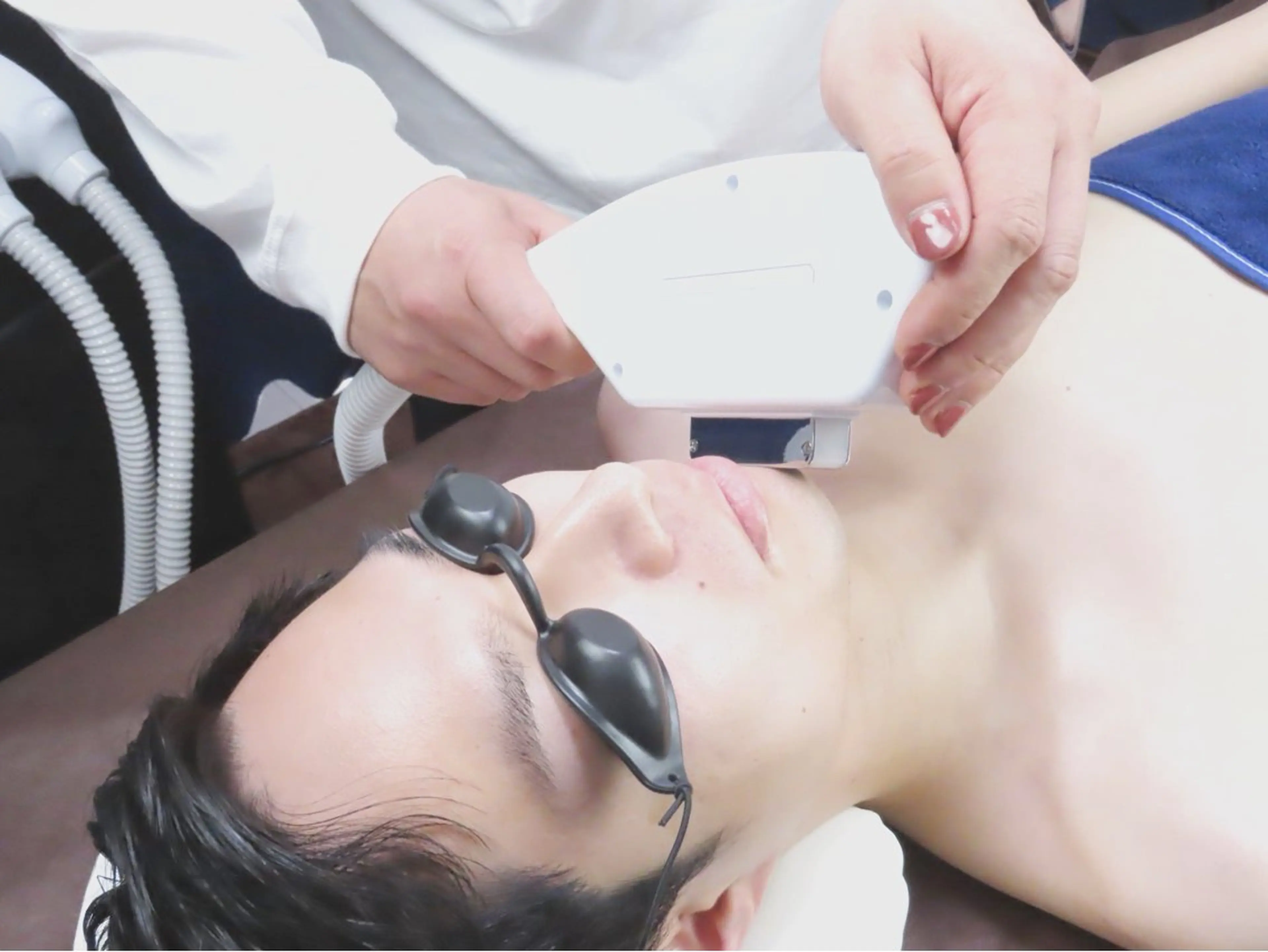 【ご新規様限定】メンズヒゲ脱毛全体の写真