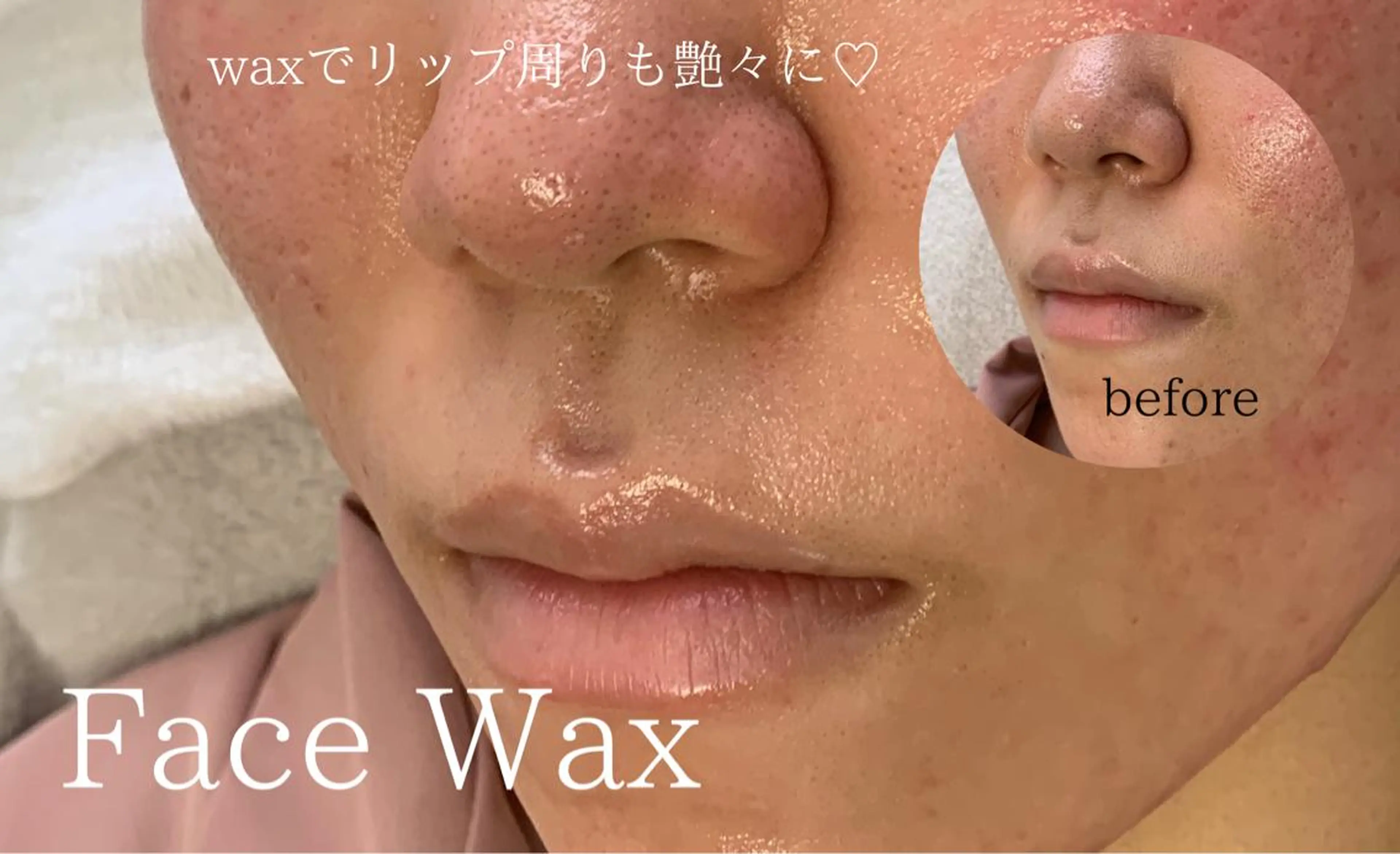 メンズ 脱毛 salonLADYSTYLE所属・稲嶺 美華のエステ・リラクイメージ