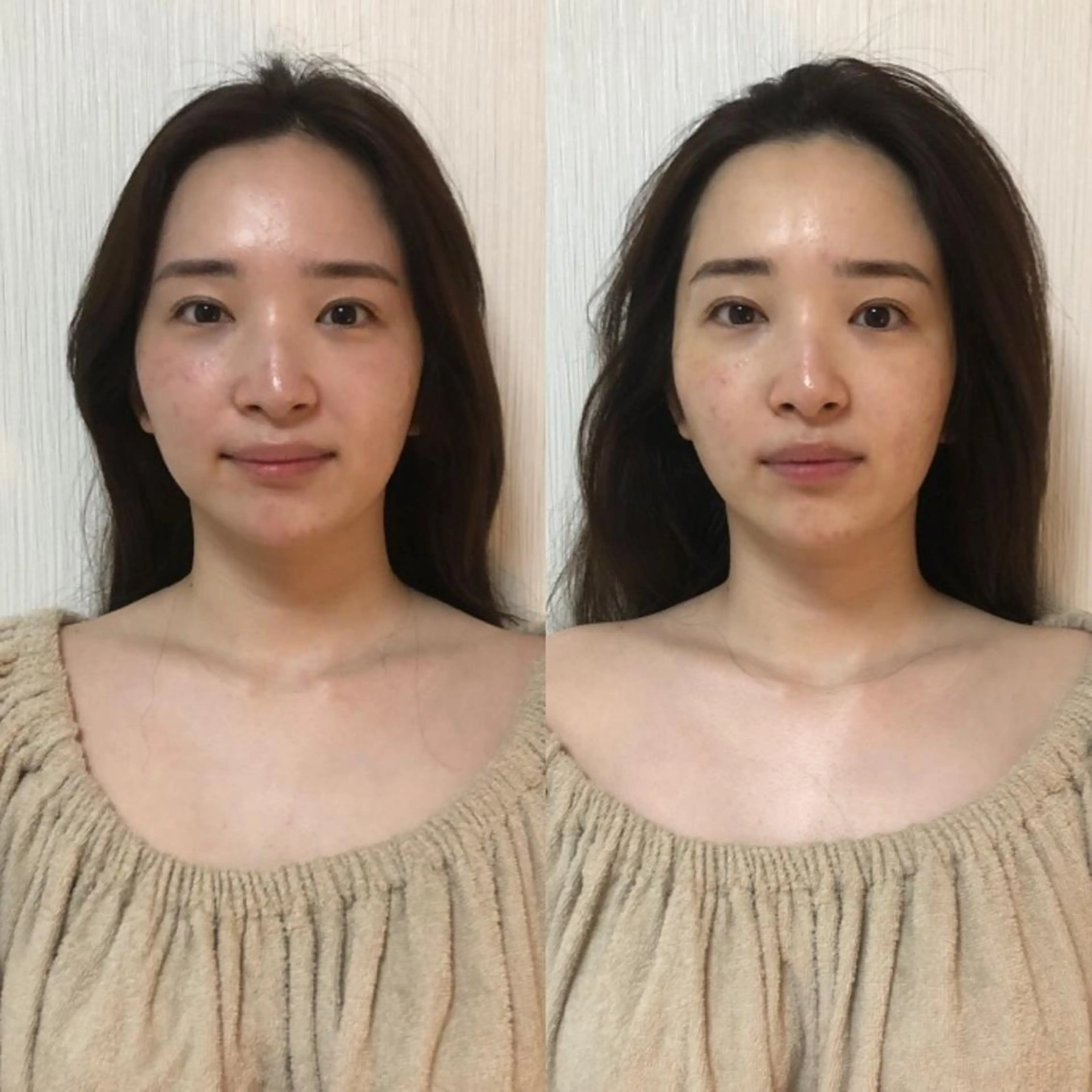 ショート カラー パーマ ヘアアレンジ ネイル マツエク・マツパ エステ リラク 小顔専門 ヘッドスパ【jiu】のエステ・リラクイメージ