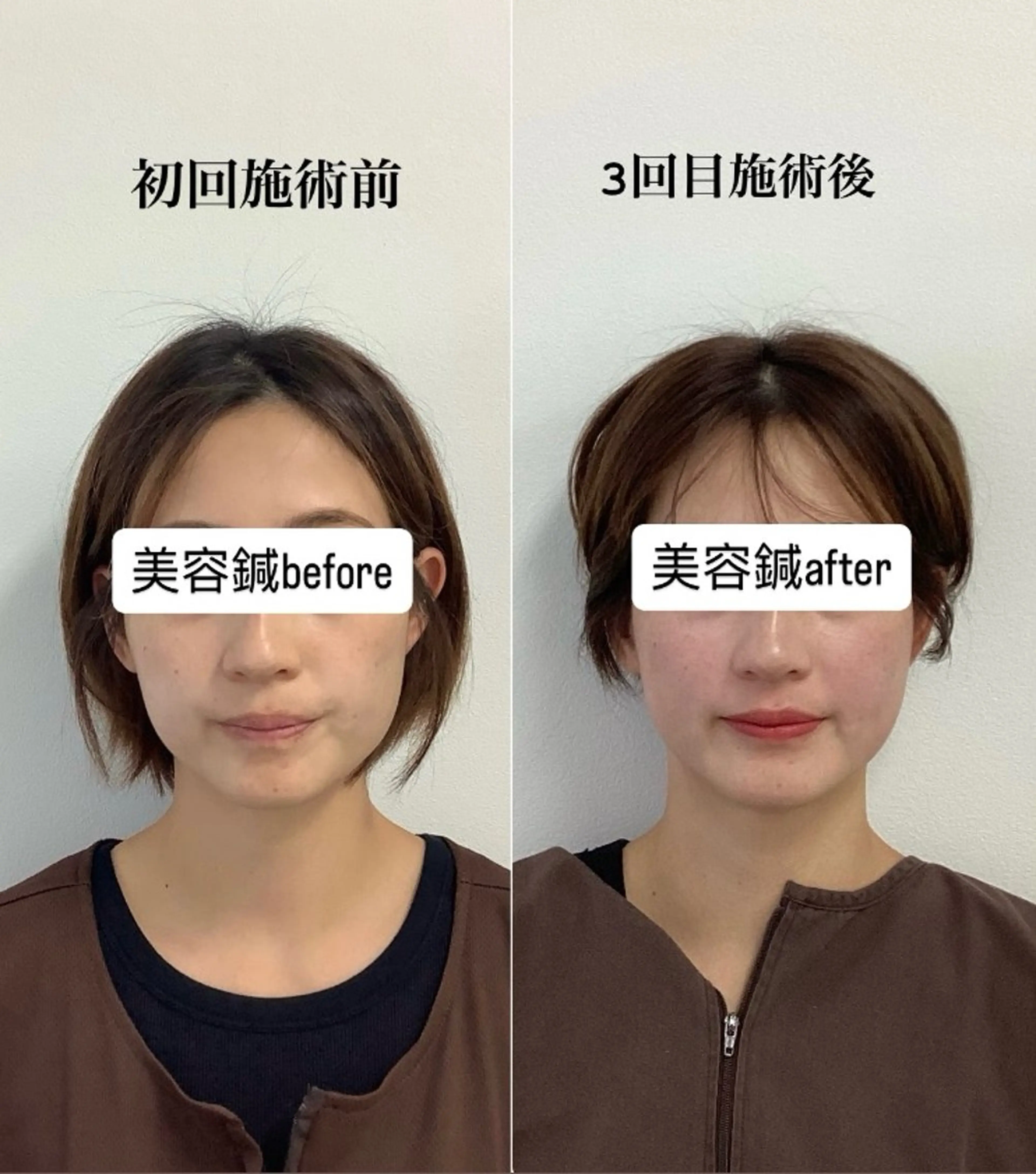 エステ リラク hari salon de off　美容鍼灸×小顔整体【ハリサロンドオフ】所属・美容鍼×小顔整体🤍 ishibashiのエステ・リラクイメージ