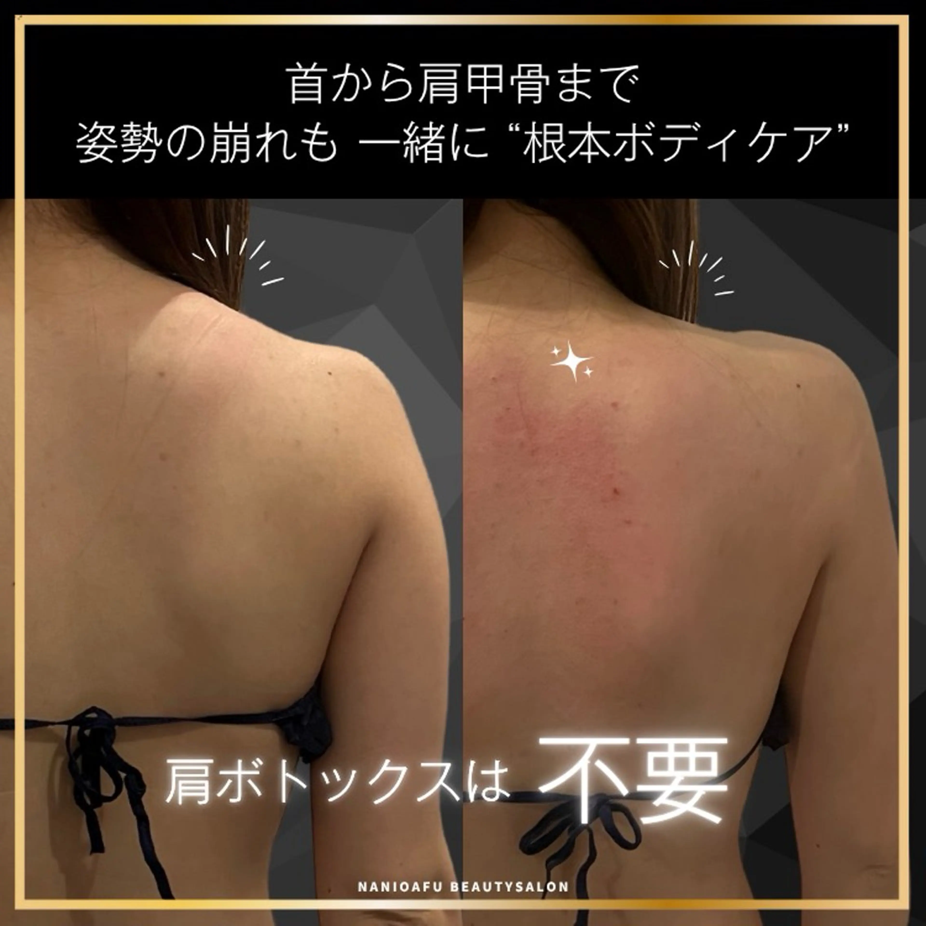 その他 NANI OAFU所属・NANIOAFU [なんば店］のエステ・リラクイメージ