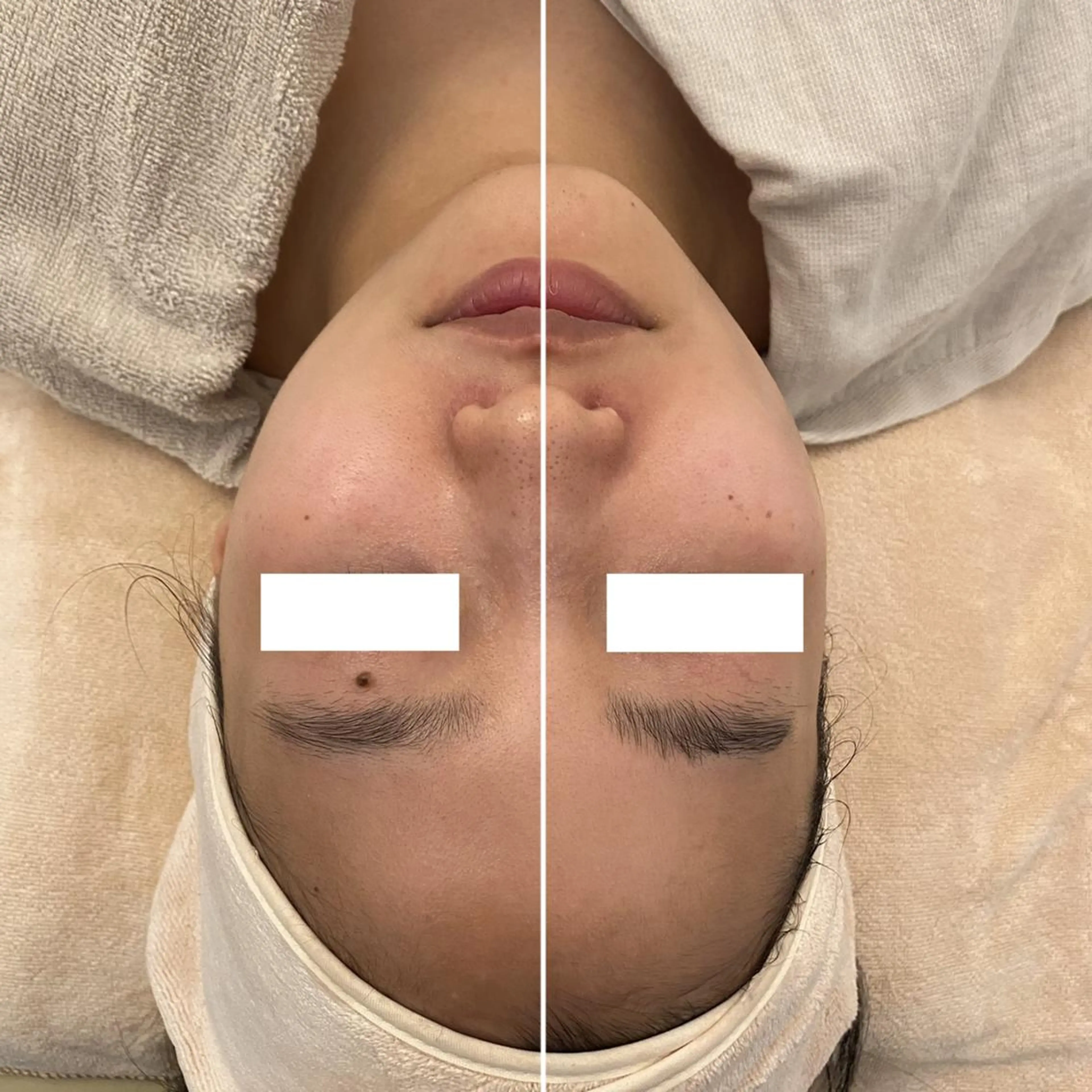 ✨美肌水光✨ アトリエリュバンのエステ・リラクイメージ