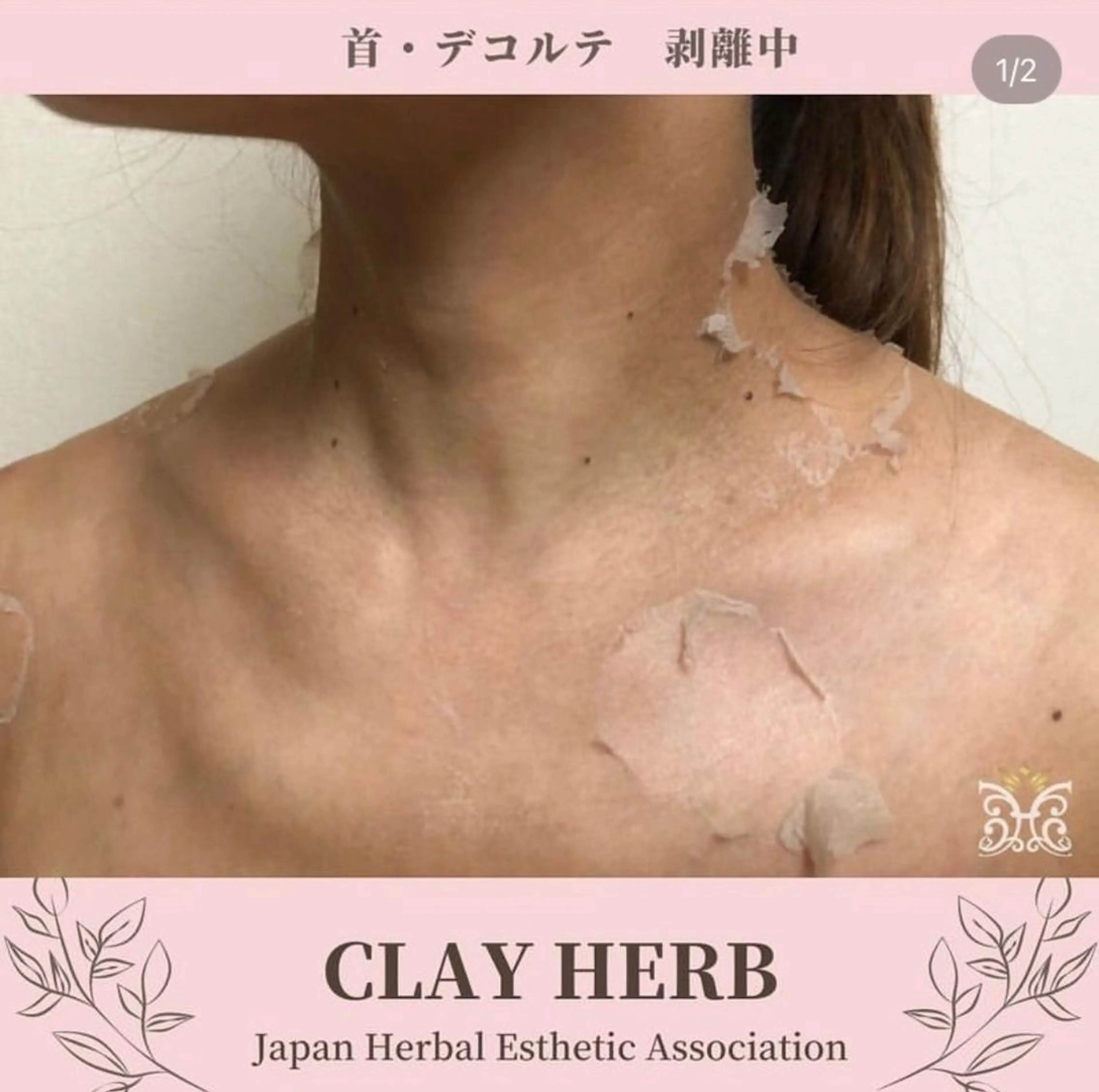 エステ リラク 【剥離ありハーブピーリング専門エステ】cerisier BEAUTÉ 原宿所属・cerisier BEAUTÉのエステ・リラクイメージ