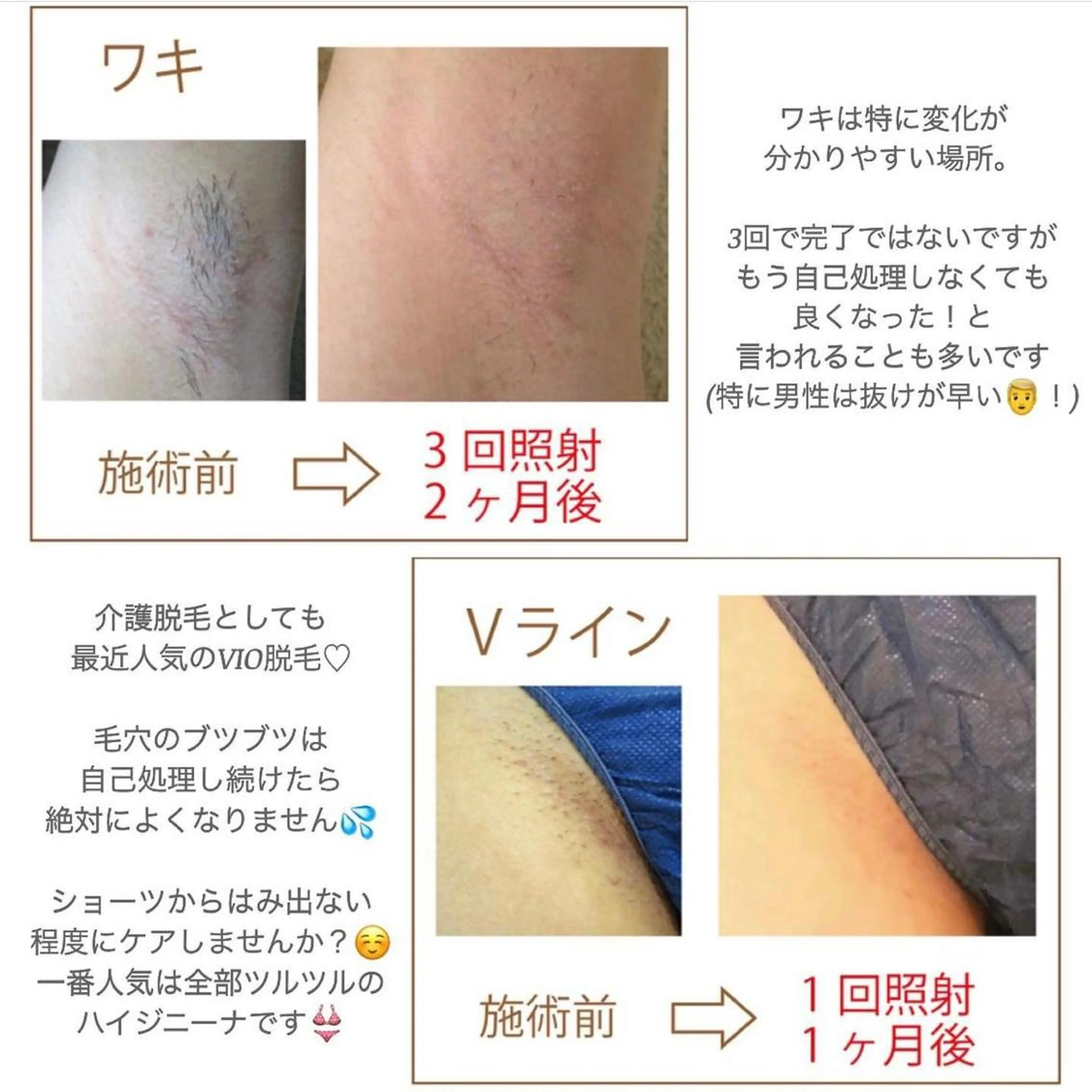 シミケアサロン REVIASオーナーのエステ・リラクイメージ