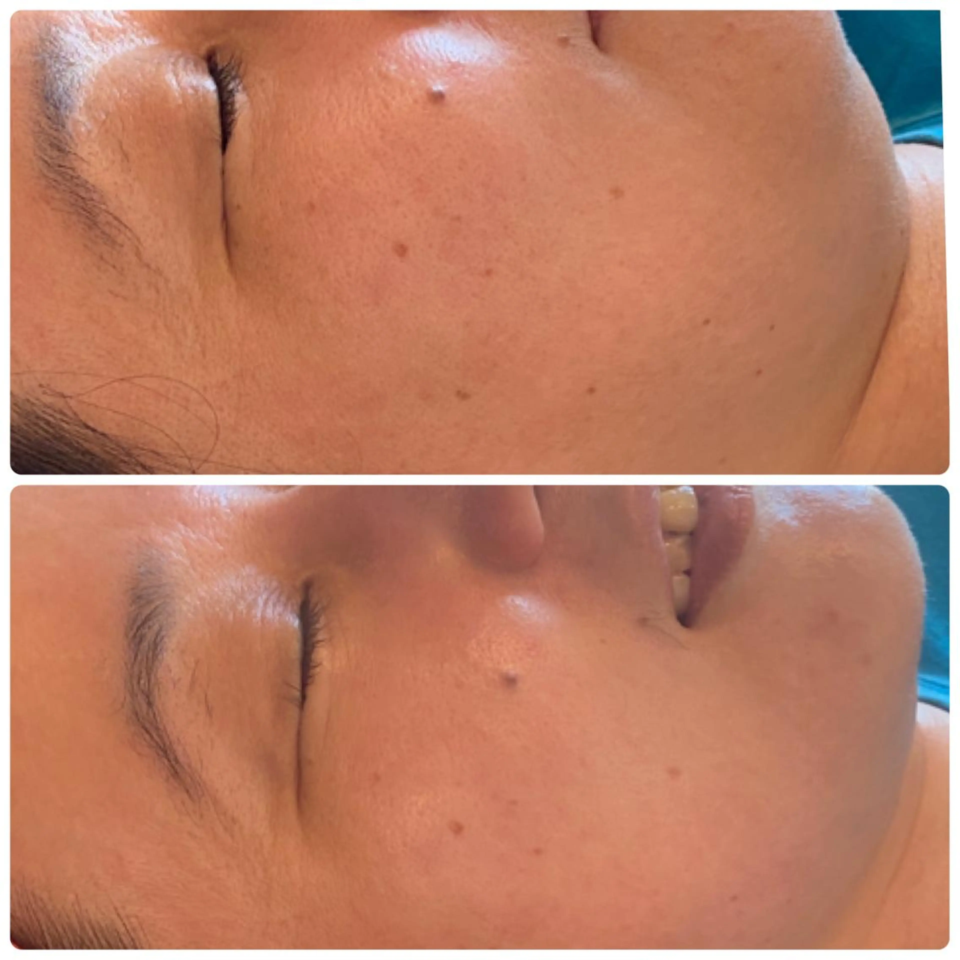 FLEUR大阪・整体 ・ハイフ・痩身・小顔のエステ・リラクイメージ