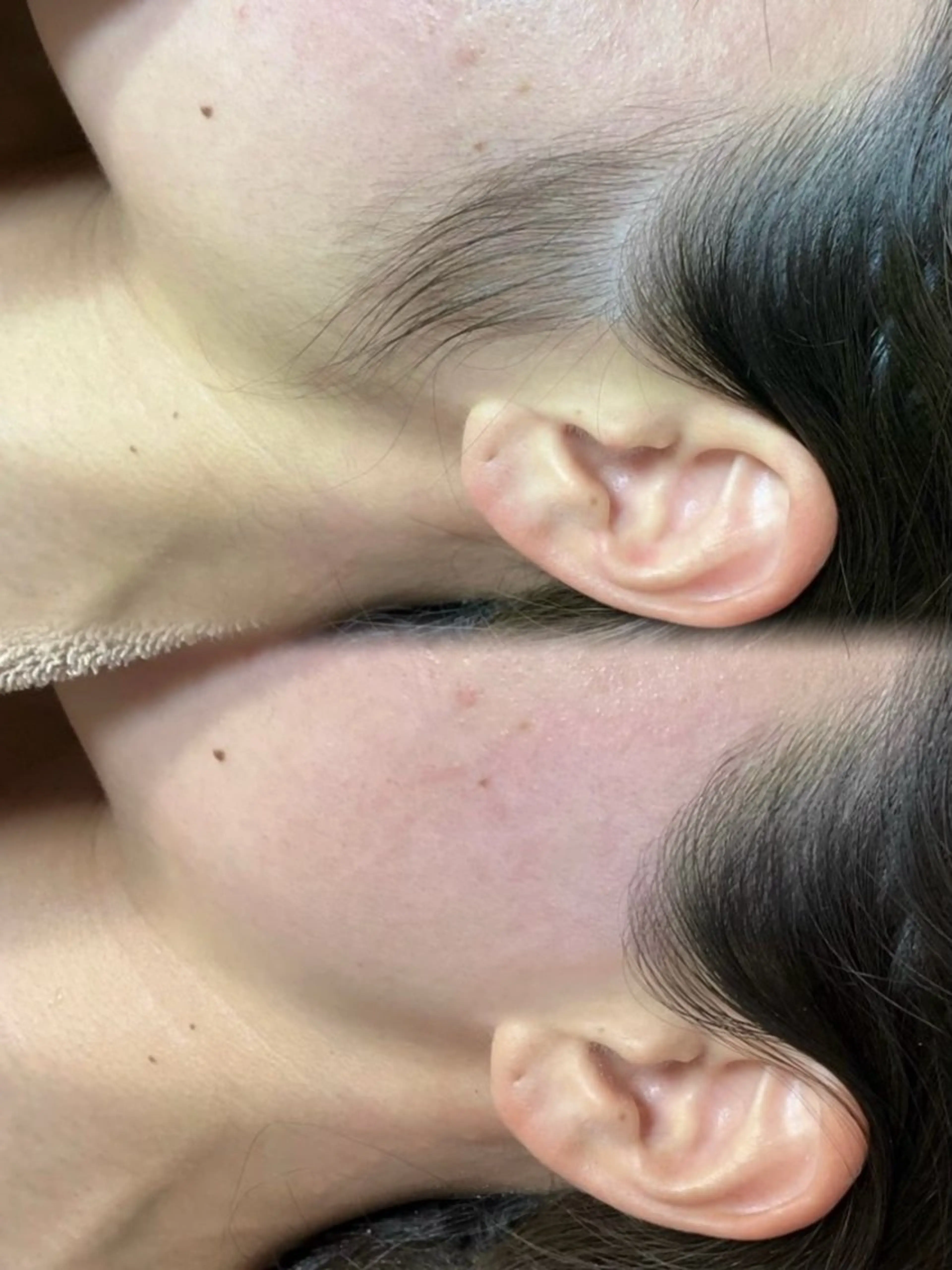 脱毛 脱毛サロンBloom所属・脱毛屋さん/池袋 /Bloom🍋わだのエステ・リラクイメージ