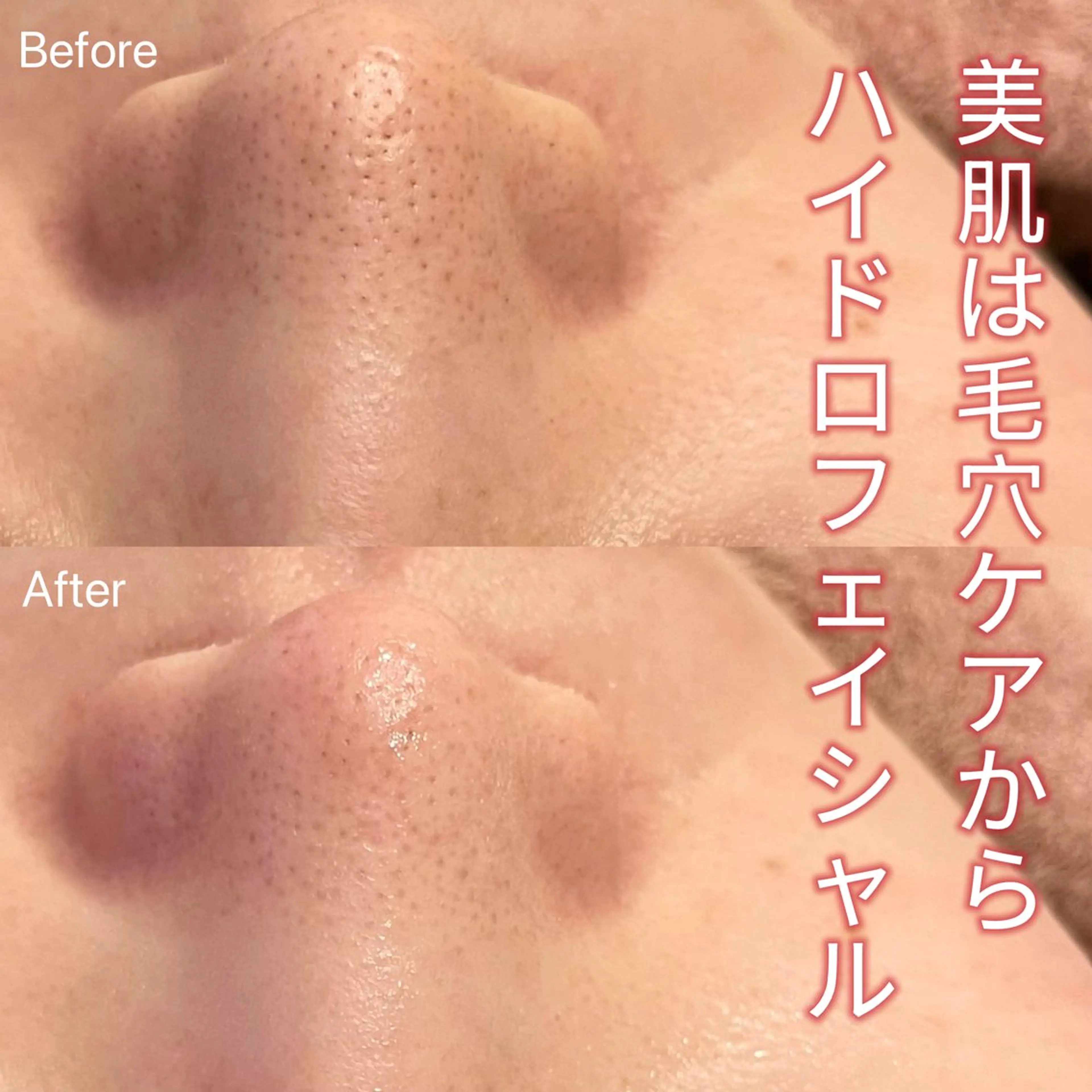 エステ アイラッシュ&エステサロンLinda西宮所属・小顔&肌質改善 LINDA西宮 AIのエステ・リラクイメージ