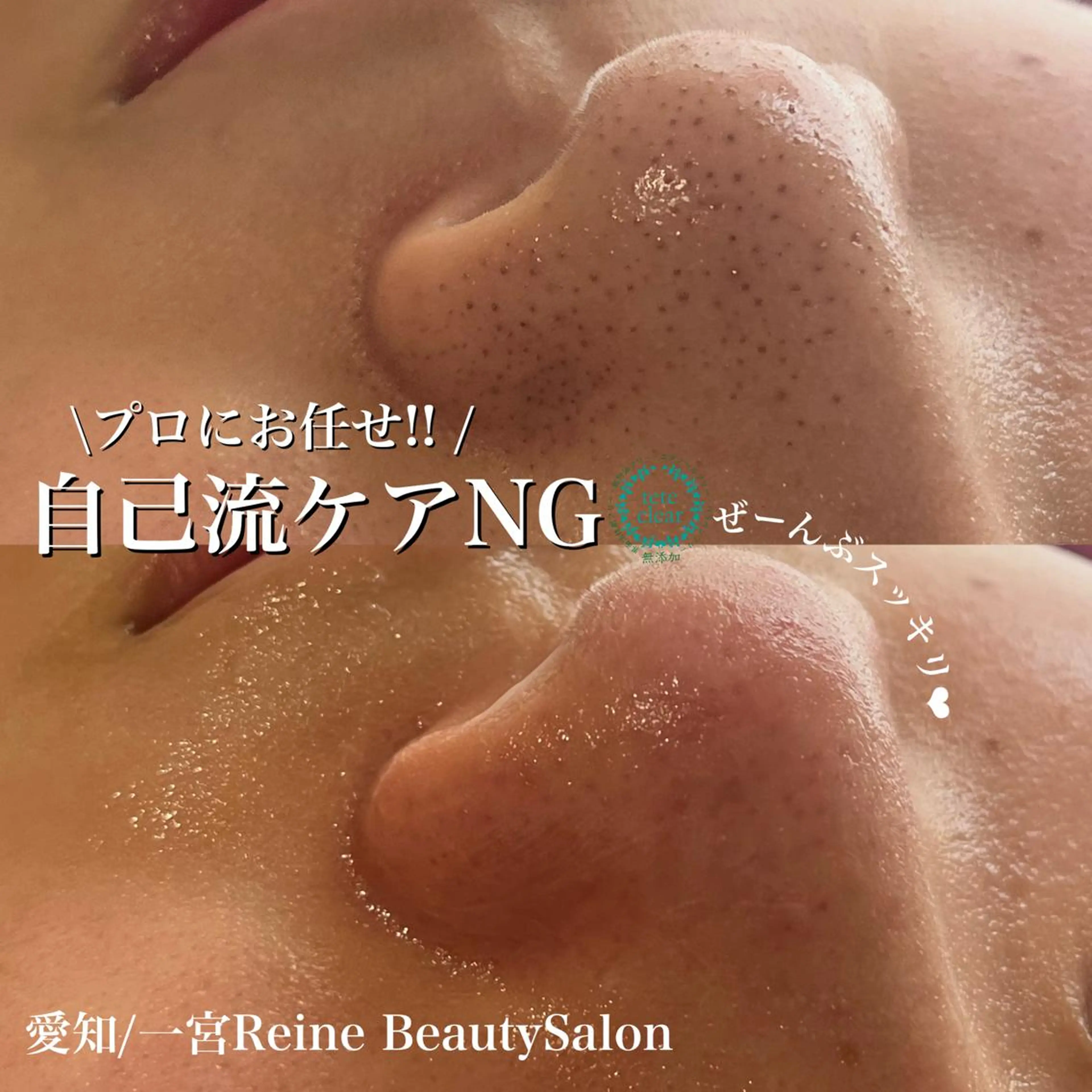 エステ Reine BeautySalon所属・毛穴/シミ肝斑/脱毛 横山梨里のエステ・リラクイメージ