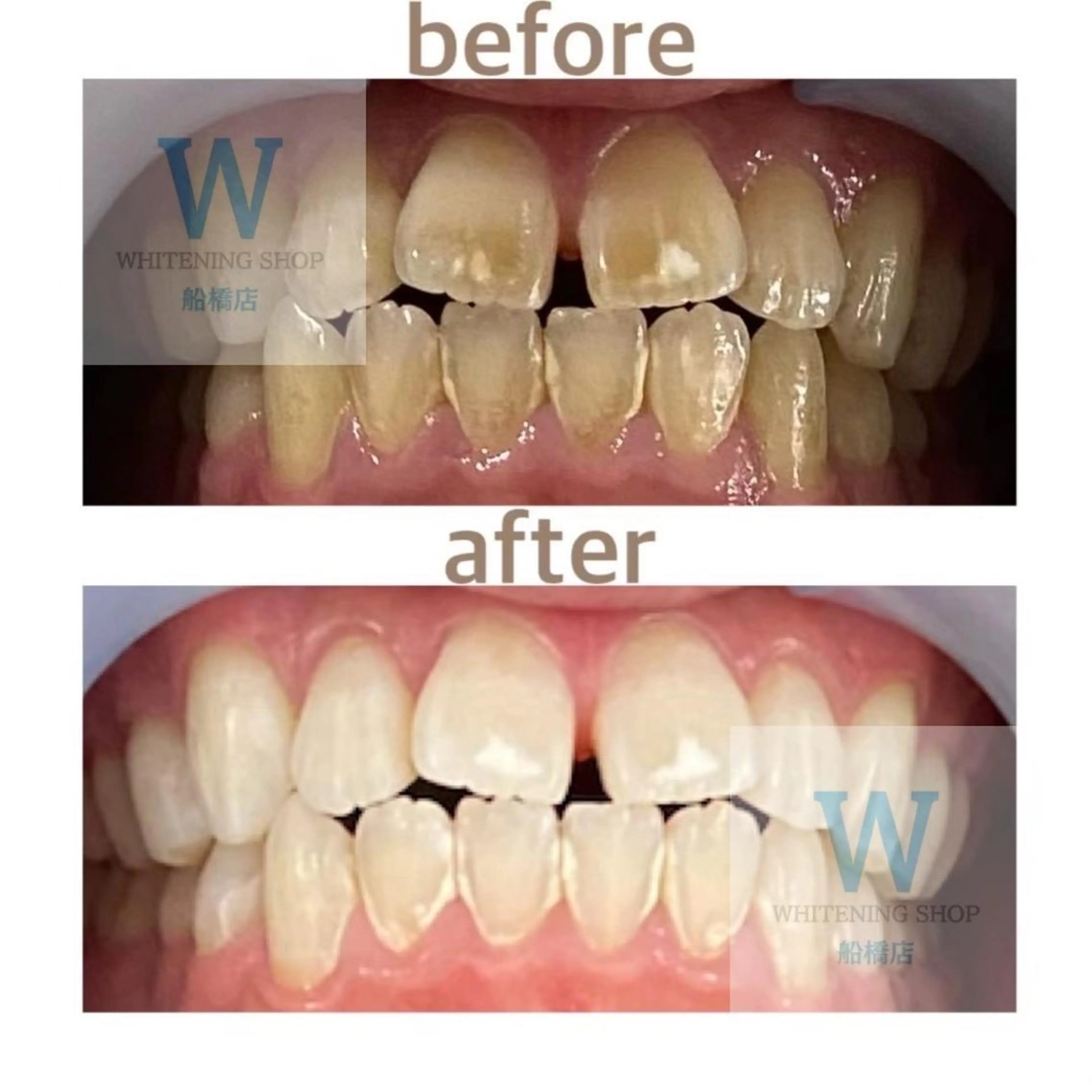 ホワイトニング ショップ船橋店のエステ・リラクイメージ