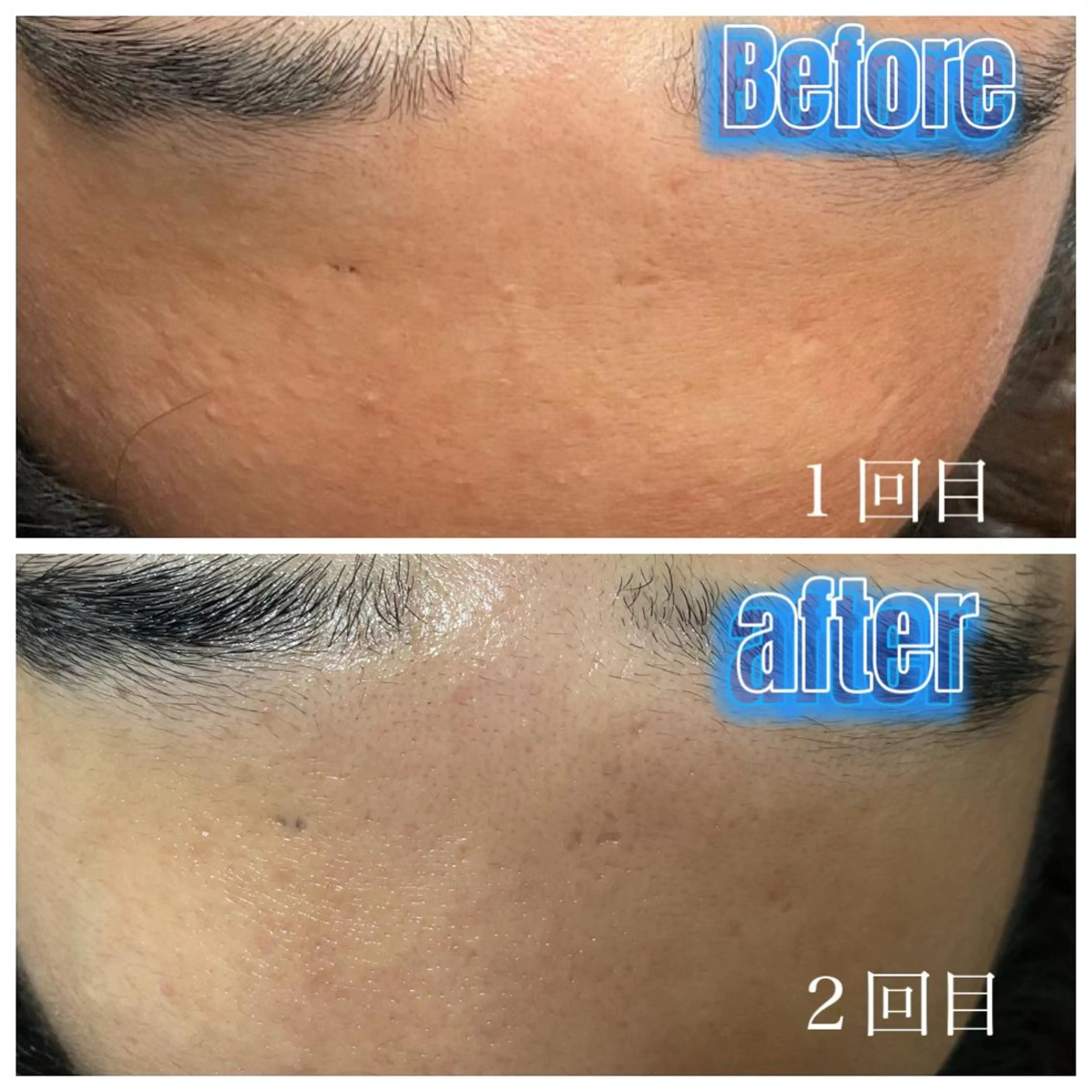 エステ 肌質改善サロン facialmoonのエステ・リラクイメージ