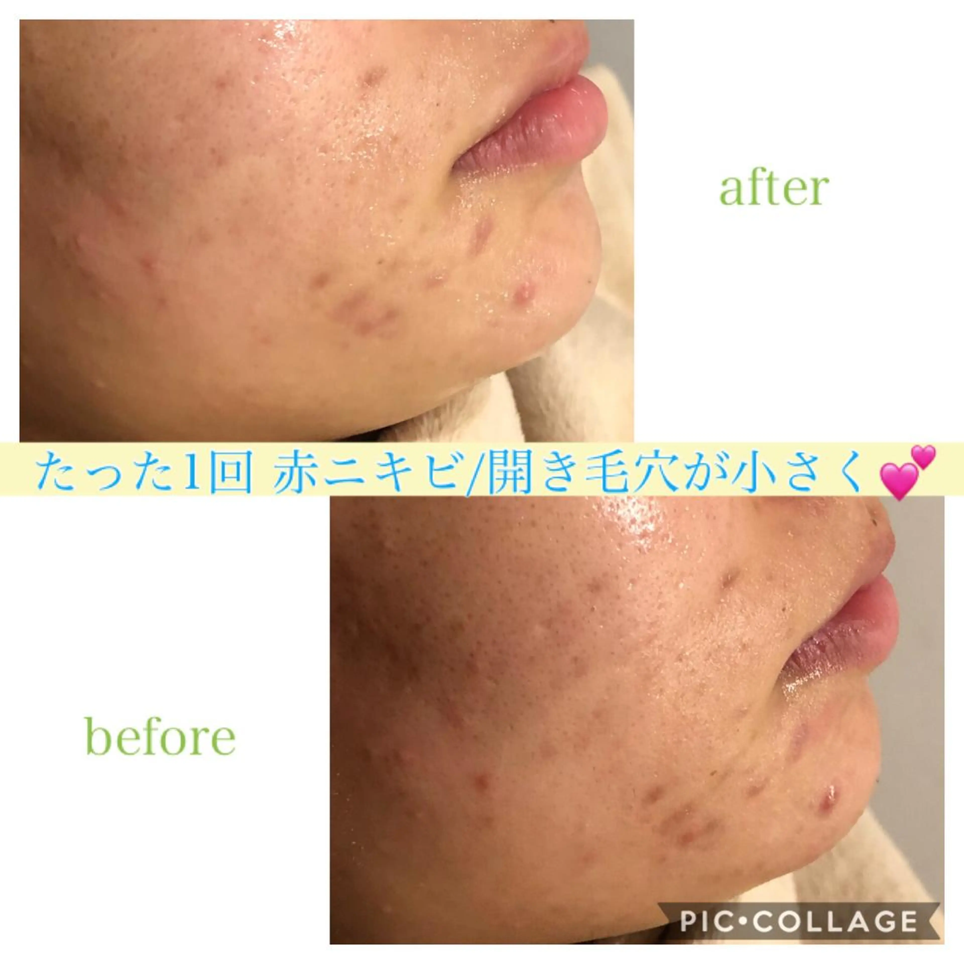 セミロング カラー パーマ ヘアアレンジ キッズ ネイル マツエク・マツパ エステ リラク Ensor Clair所属・EnsorClair 代表 野口真央のエステ・リラクイメージ