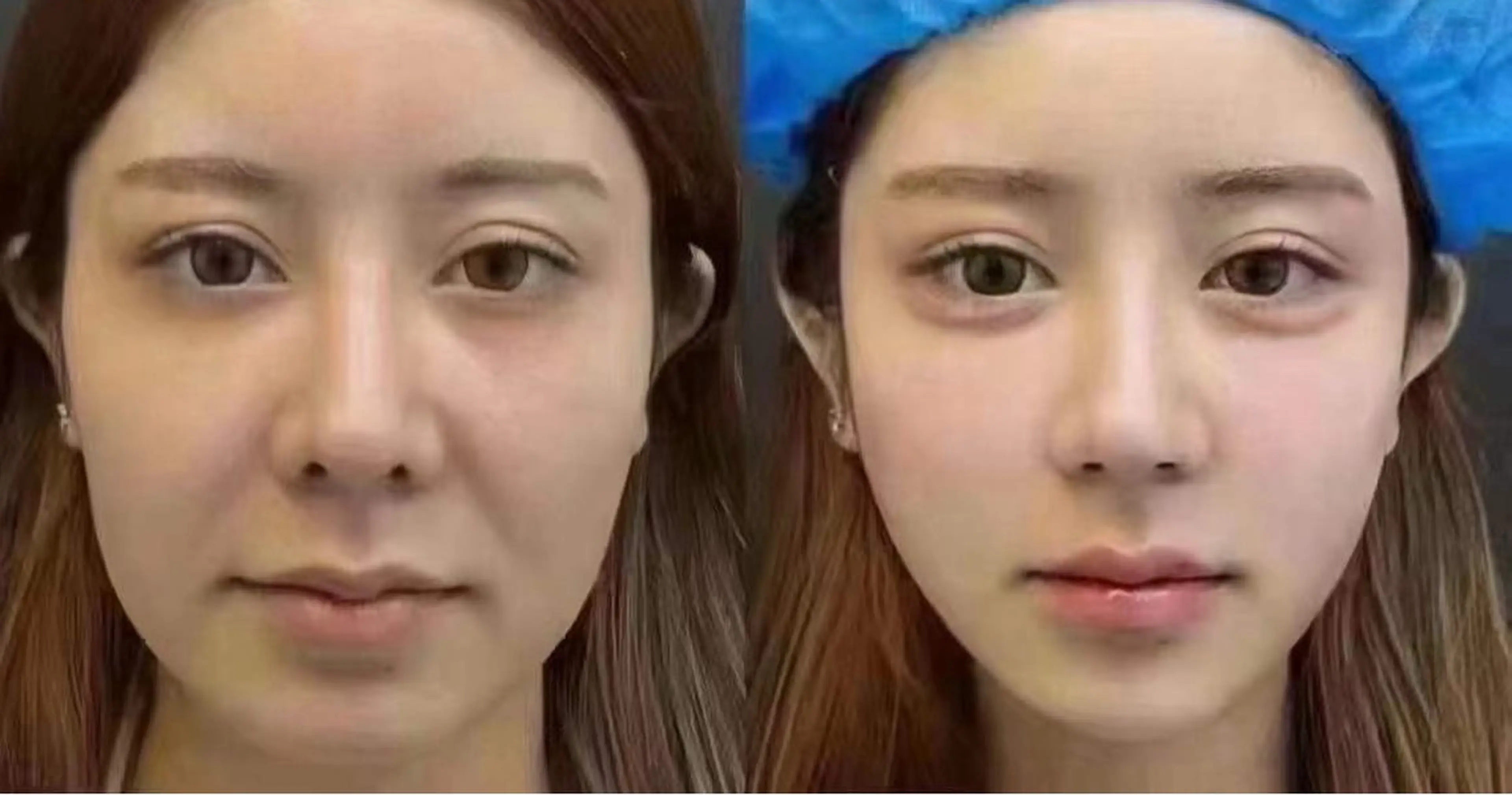 マツエク・マツパ 結婚式・ブライダル エステ aliaハイフ&水光ジェットサロン所属・aliaハーブ水光店 エステティシャン募集のエステ・リラクイメージ