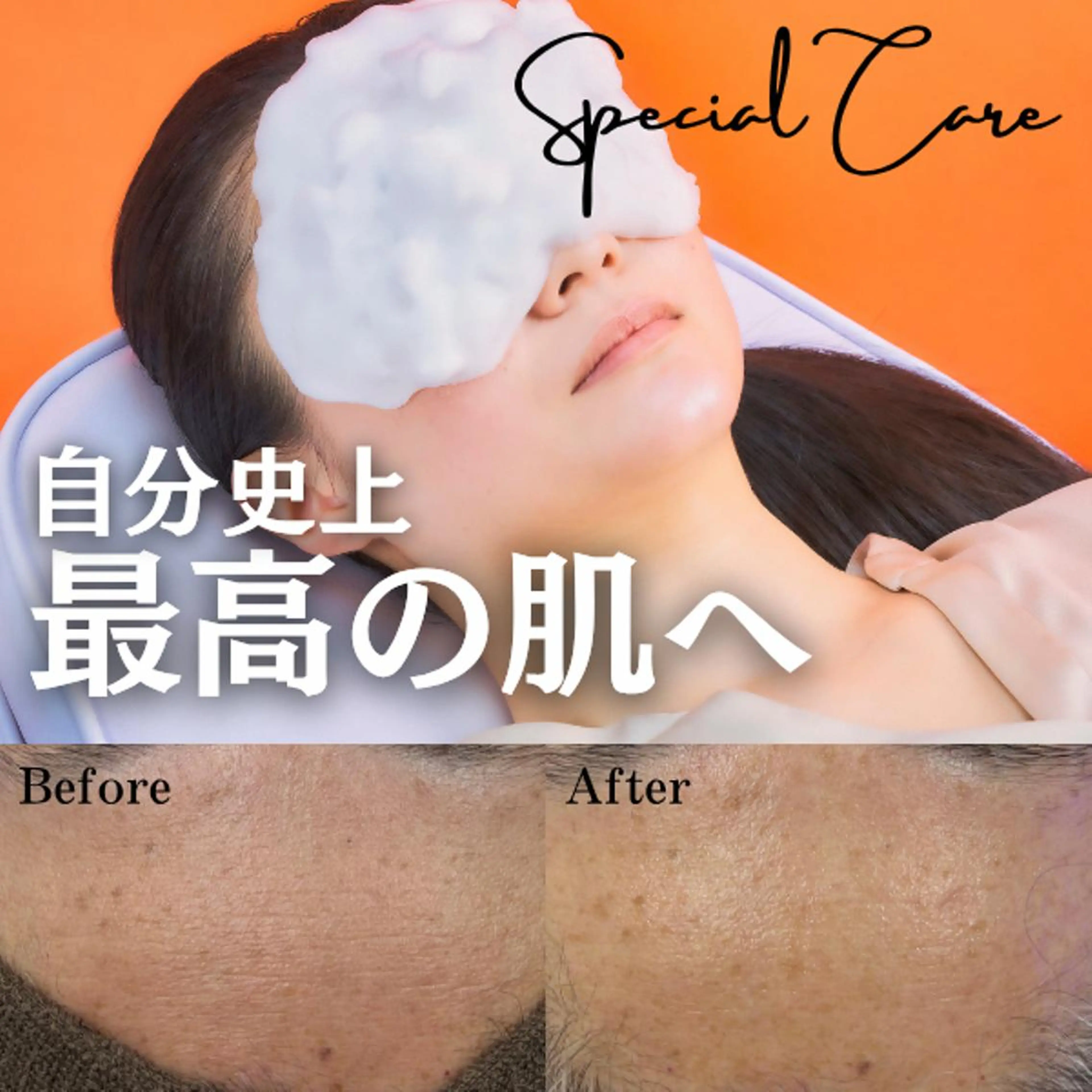 【40代に多い肌トラブルを改善】くすみ・乾燥・シワが気になる方に。メンズの写真
