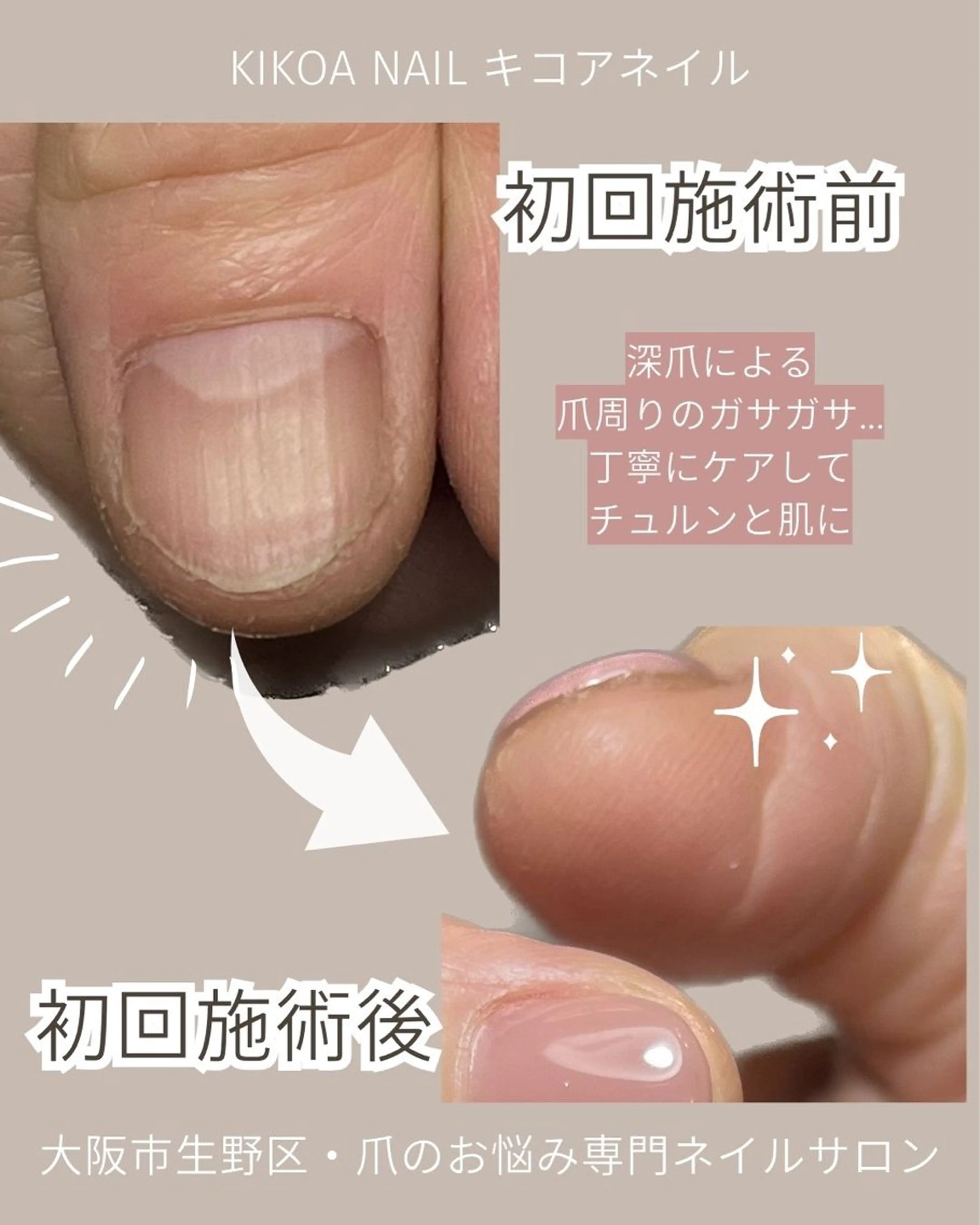 ネイル KIKOA NAIL キコアネイルのネイルデザイン