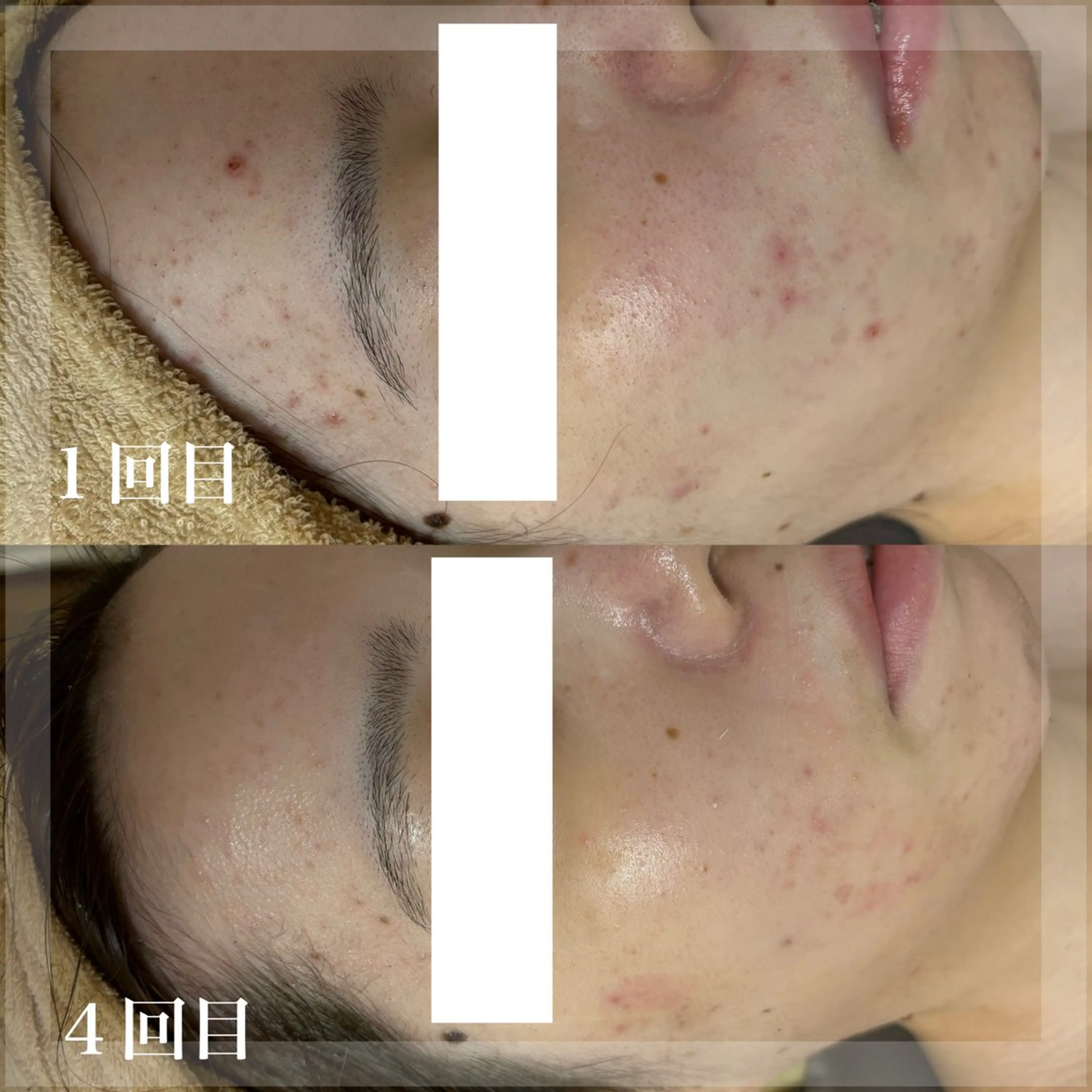 エステ WHITE AQUA 北千住店のエステ・リラクイメージ