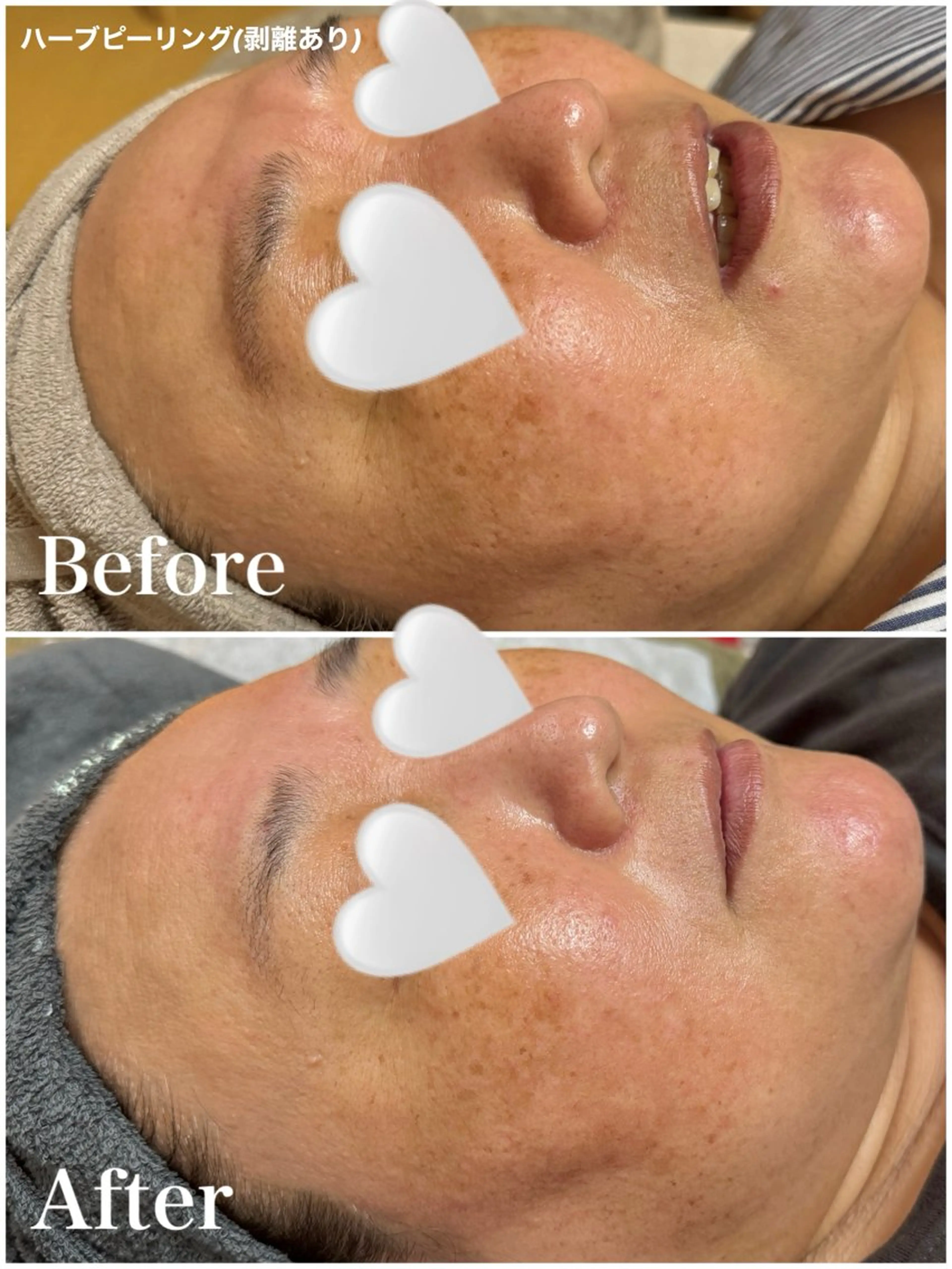 エステ Ayaka🤍 恵比寿/美容鍼/整体のエステ・リラクイメージ