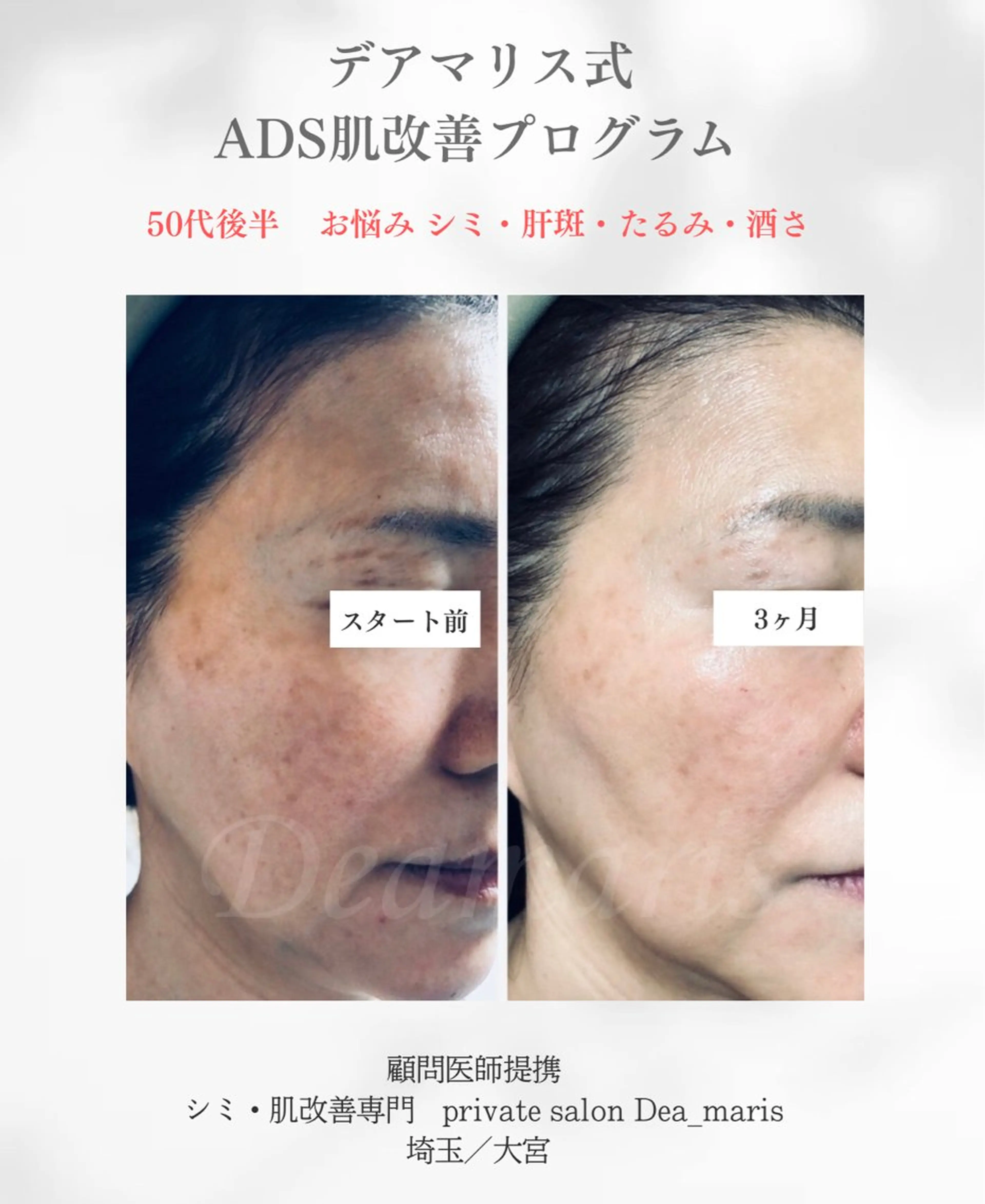 private salon  Dea_maris シュガーリング＆パーソナルボディケア所属・シミ改善・韓国肌管理 ボディメイク痩身のその他イメージ