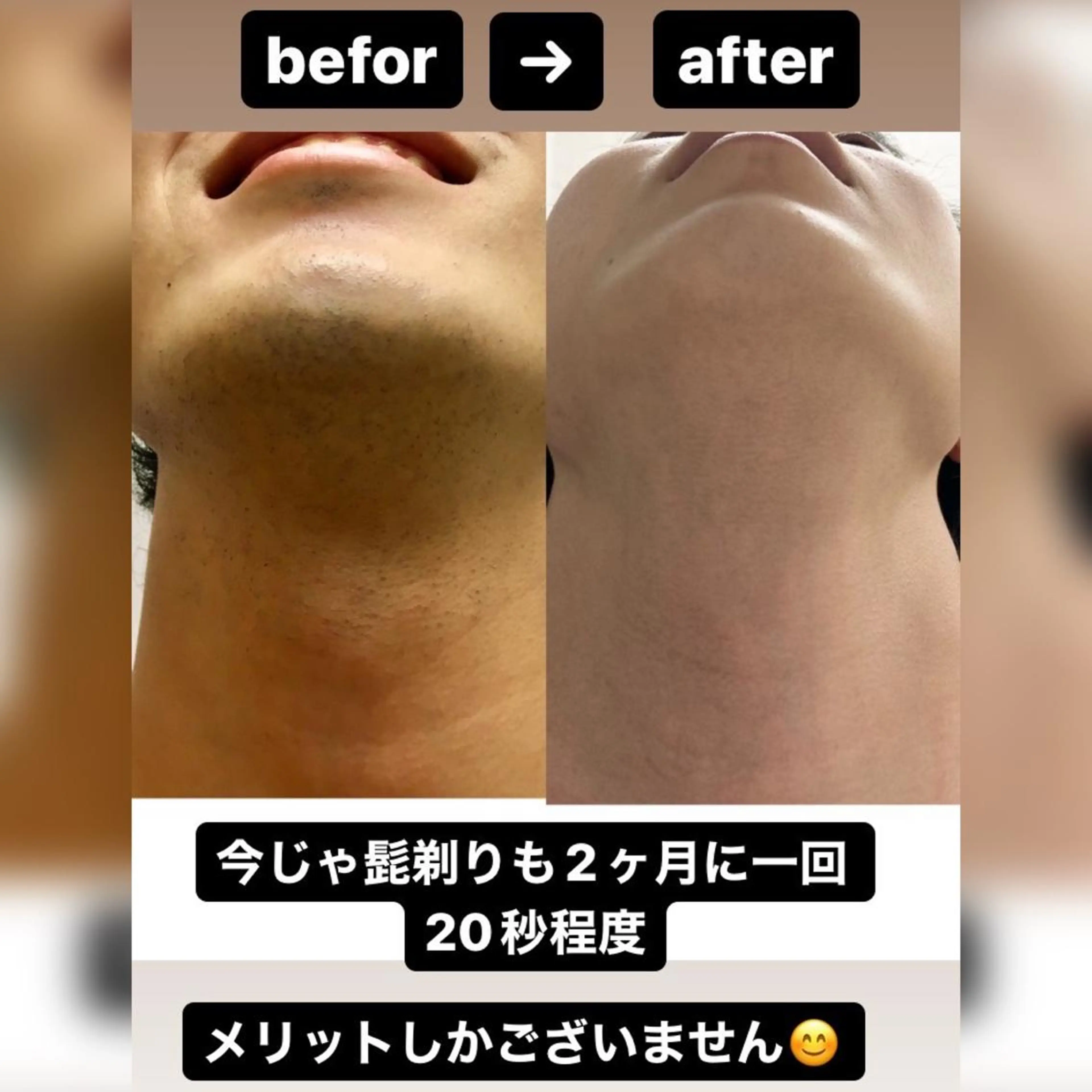 メンズ 脱毛 Beauty K's【ビューティーケイズ】所属・メンズ脱毛サロン ／金山昌弘のエステ・リラクイメージ