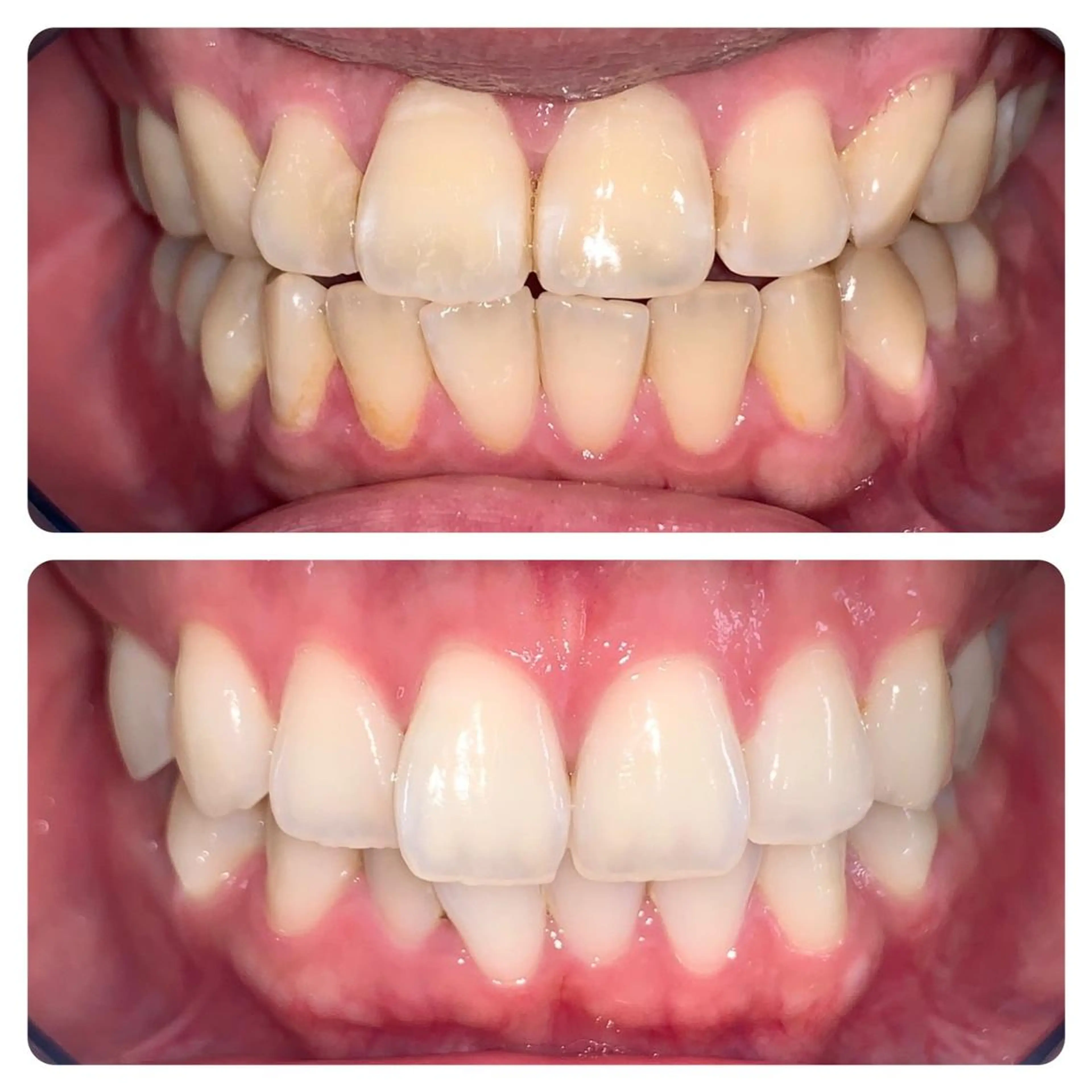 ネイル アイブロウ マツエク・マツパ メンズ パーマ ロング カラー ホワイト その他 ライトビューティー 銀座本店のエステ・リラクイメージ