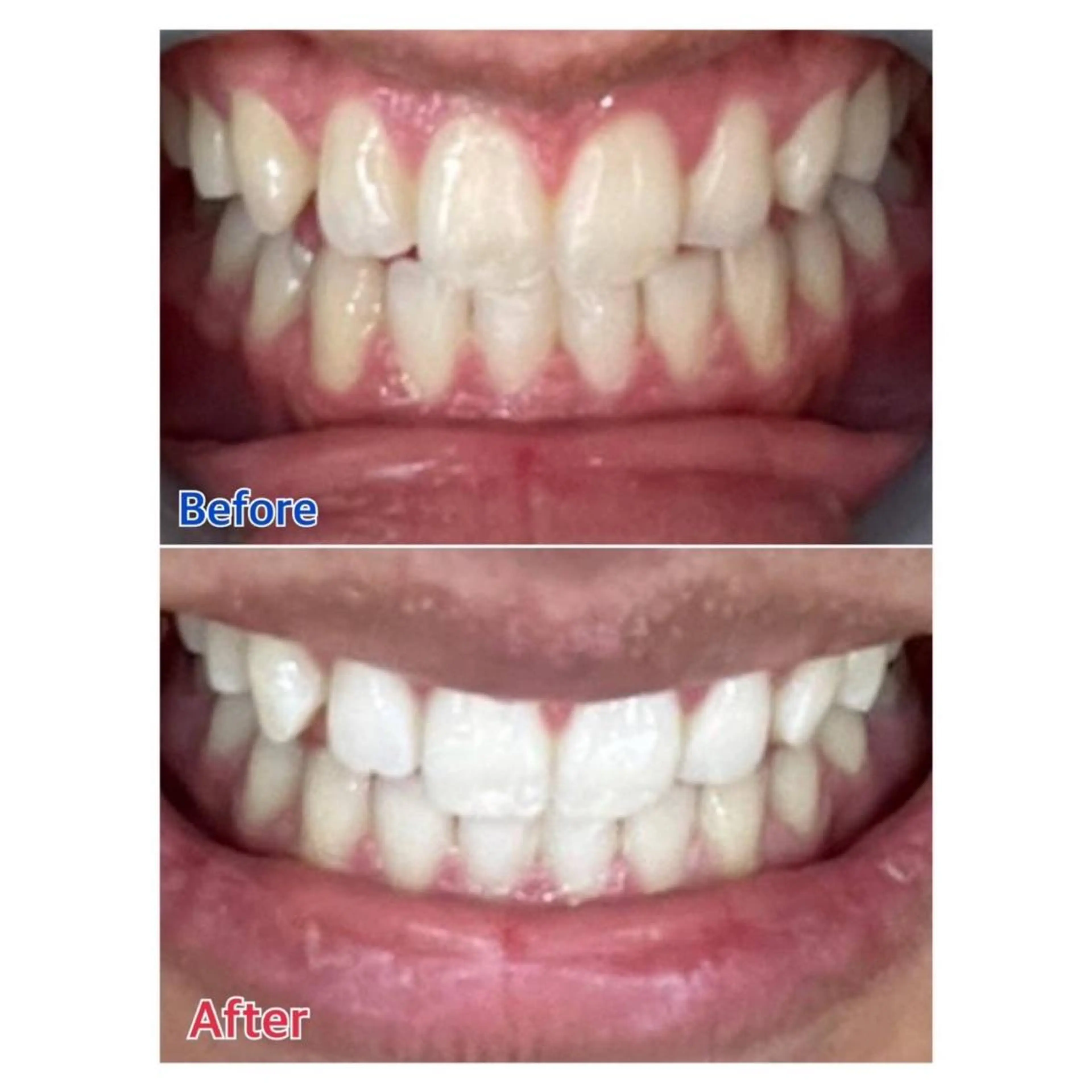 MBEAUTYSALON 千葉店・京成大久保所属・Melty 輝のその他イメージ