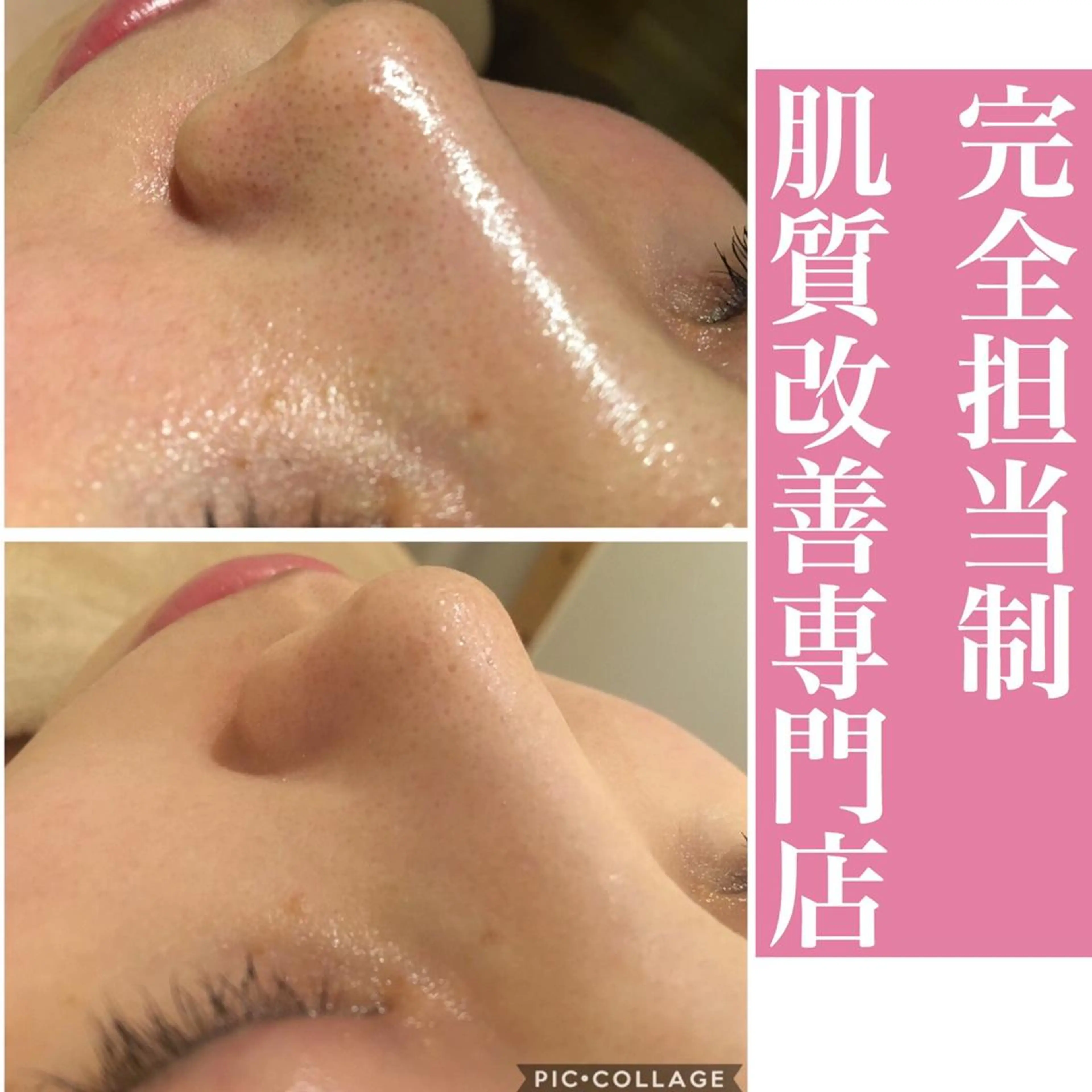 ミディアム カラー パーマ ヘアアレンジ メンズ キッズ ネイル マツエク・マツパ アイブロウ エステ リラク アクール　齋藤 ♡肌トラブル卒業のエステ・リラクイメージ