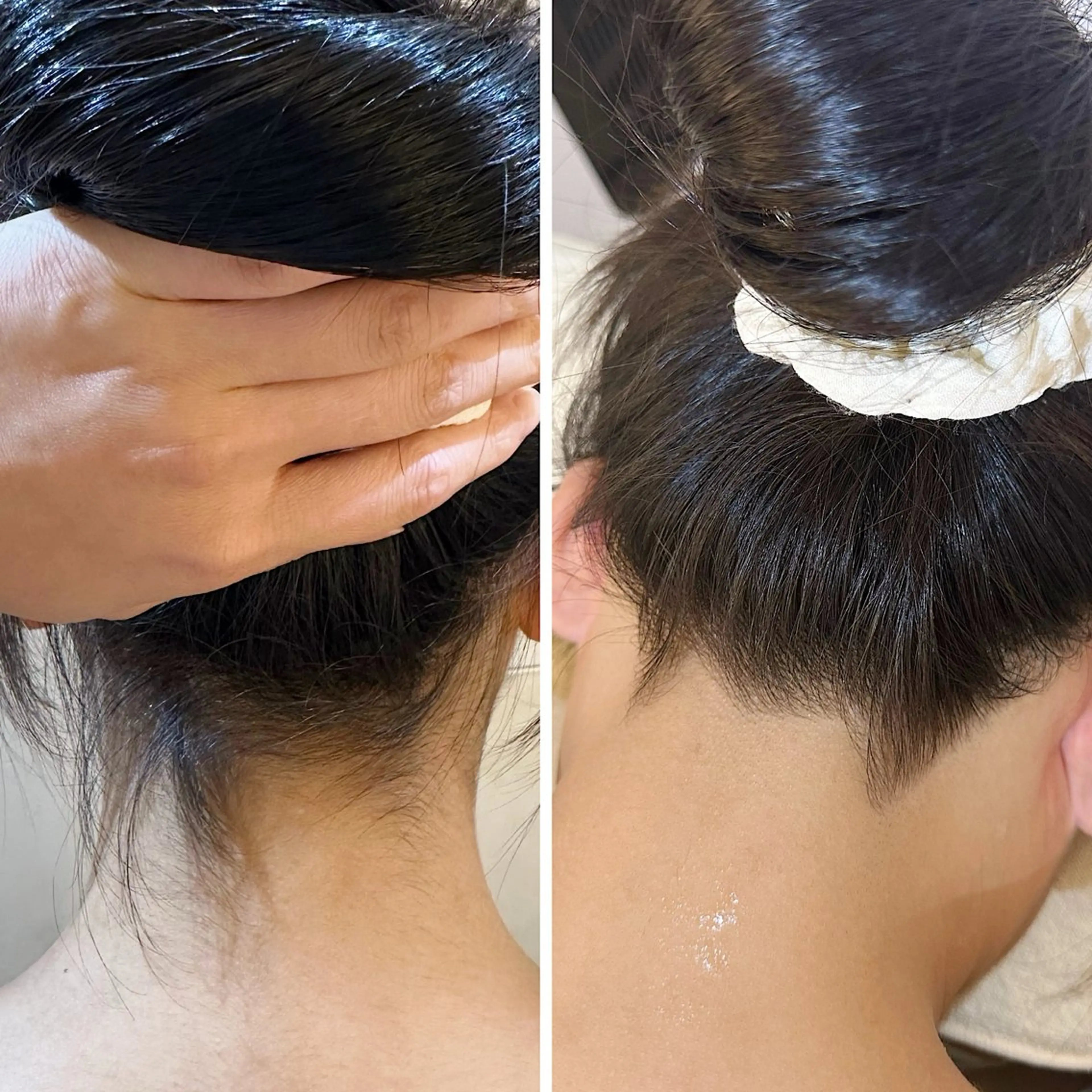 脱毛 うなじ脱毛/美肌脱毛 LABELのエステ・リラクイメージ