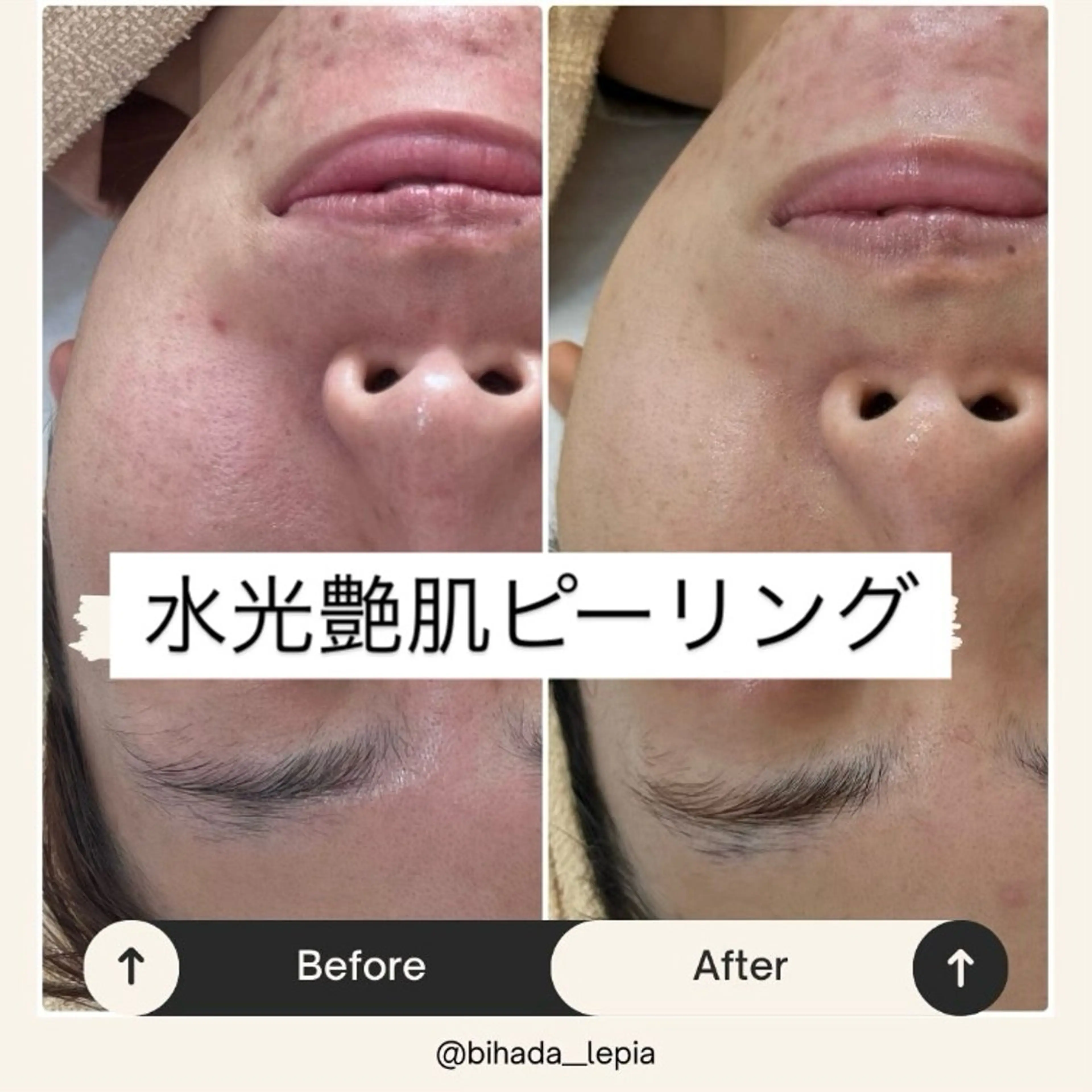 エステ リラク 肌質管理専門店 Lé pia　AMIのエステ・リラクイメージ