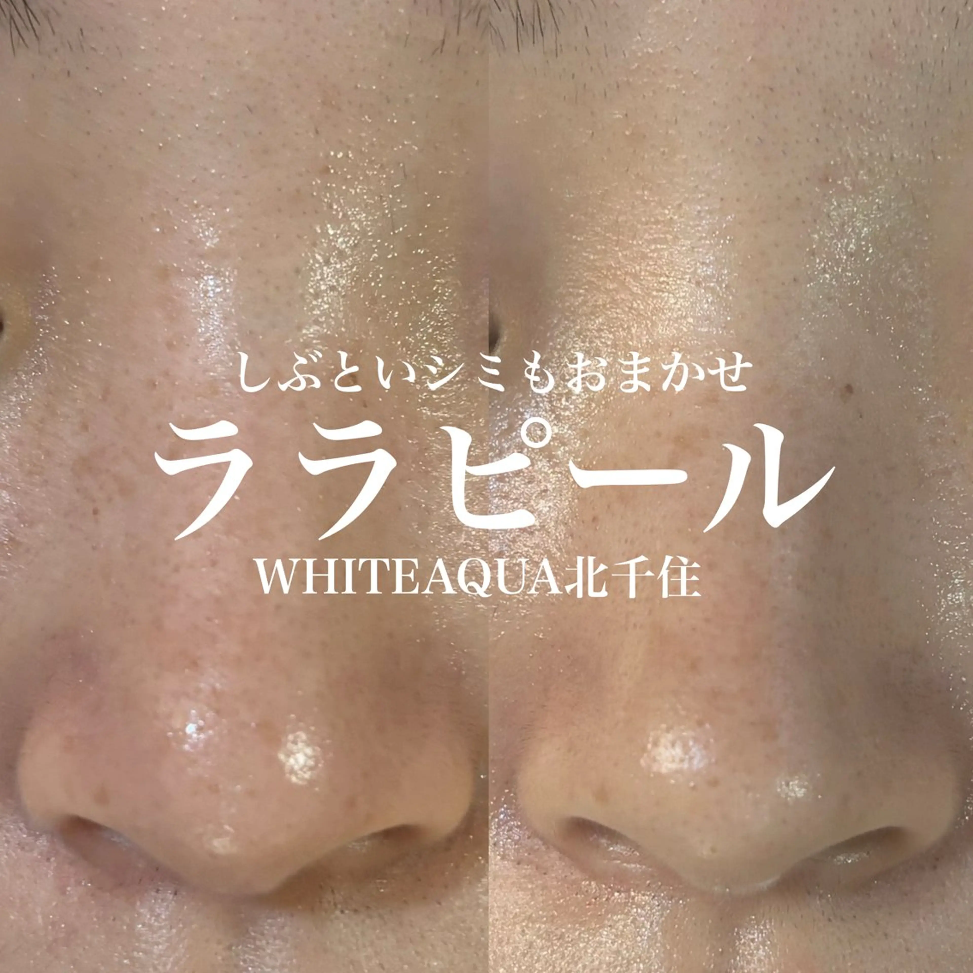 エステ WHITE AQUA 北千住店のエステ・リラクイメージ