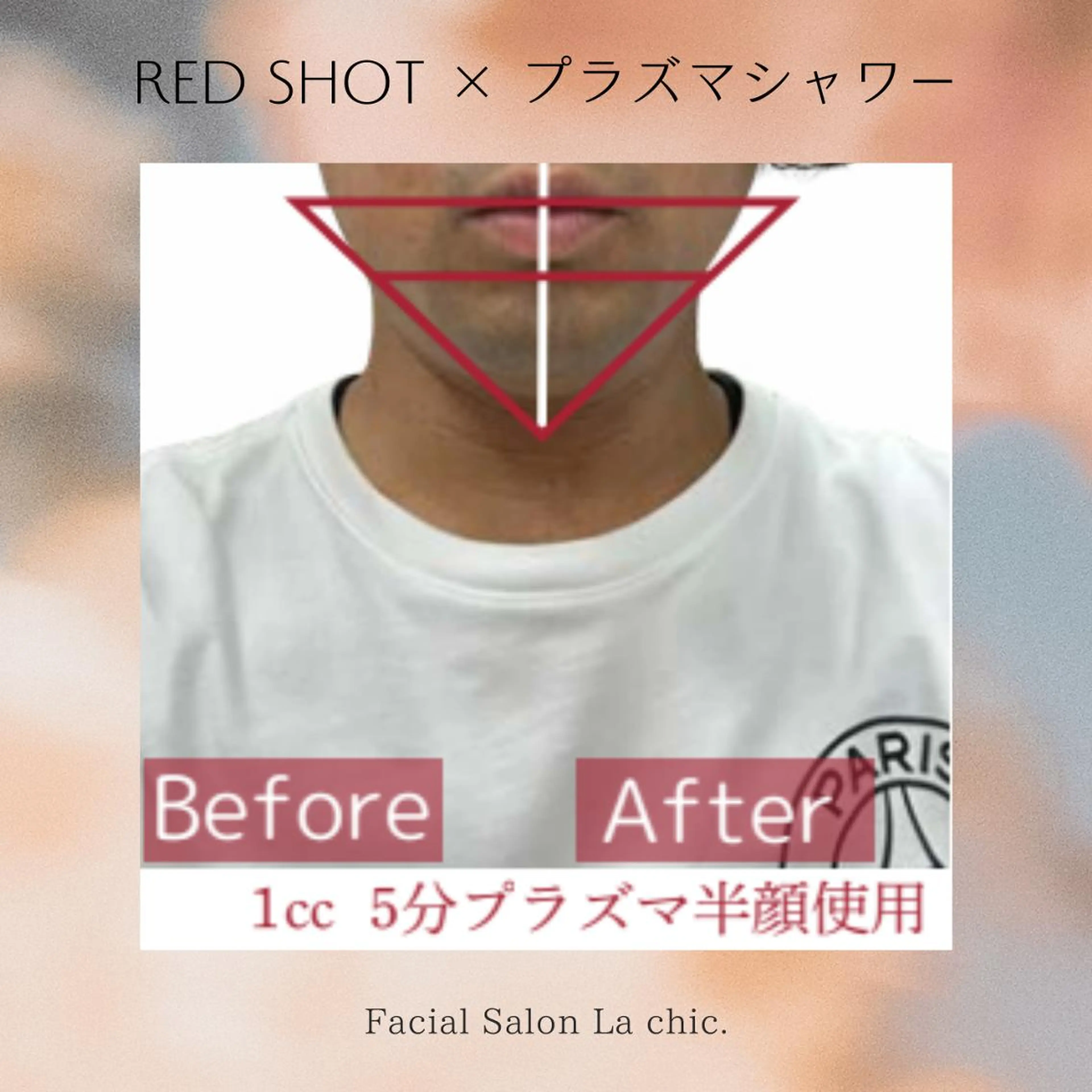 エステ La chic. 加古川のエステ・リラクイメージ