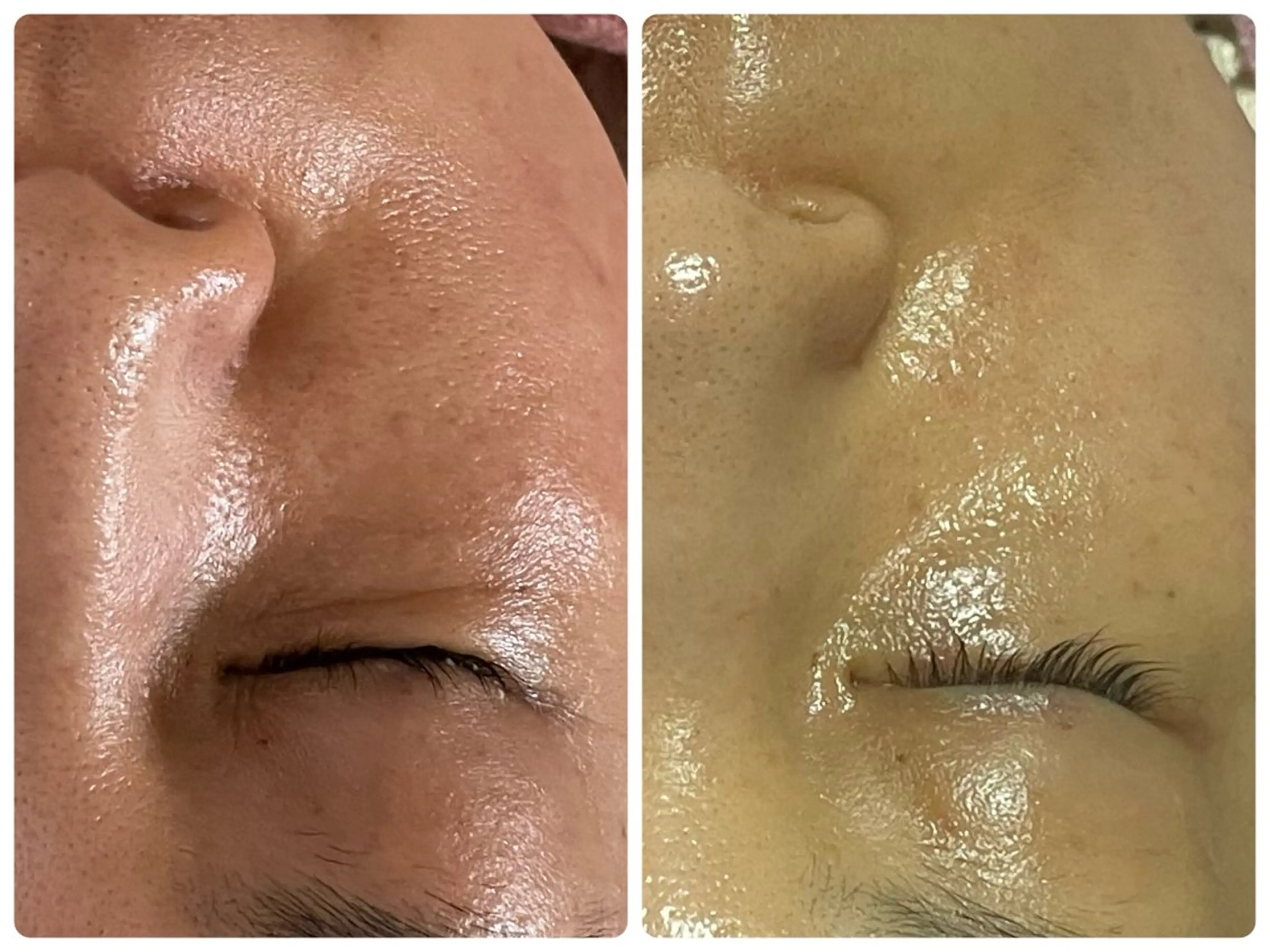 Salon Rion所属・Rion 野々村のエステ・リラクイメージ