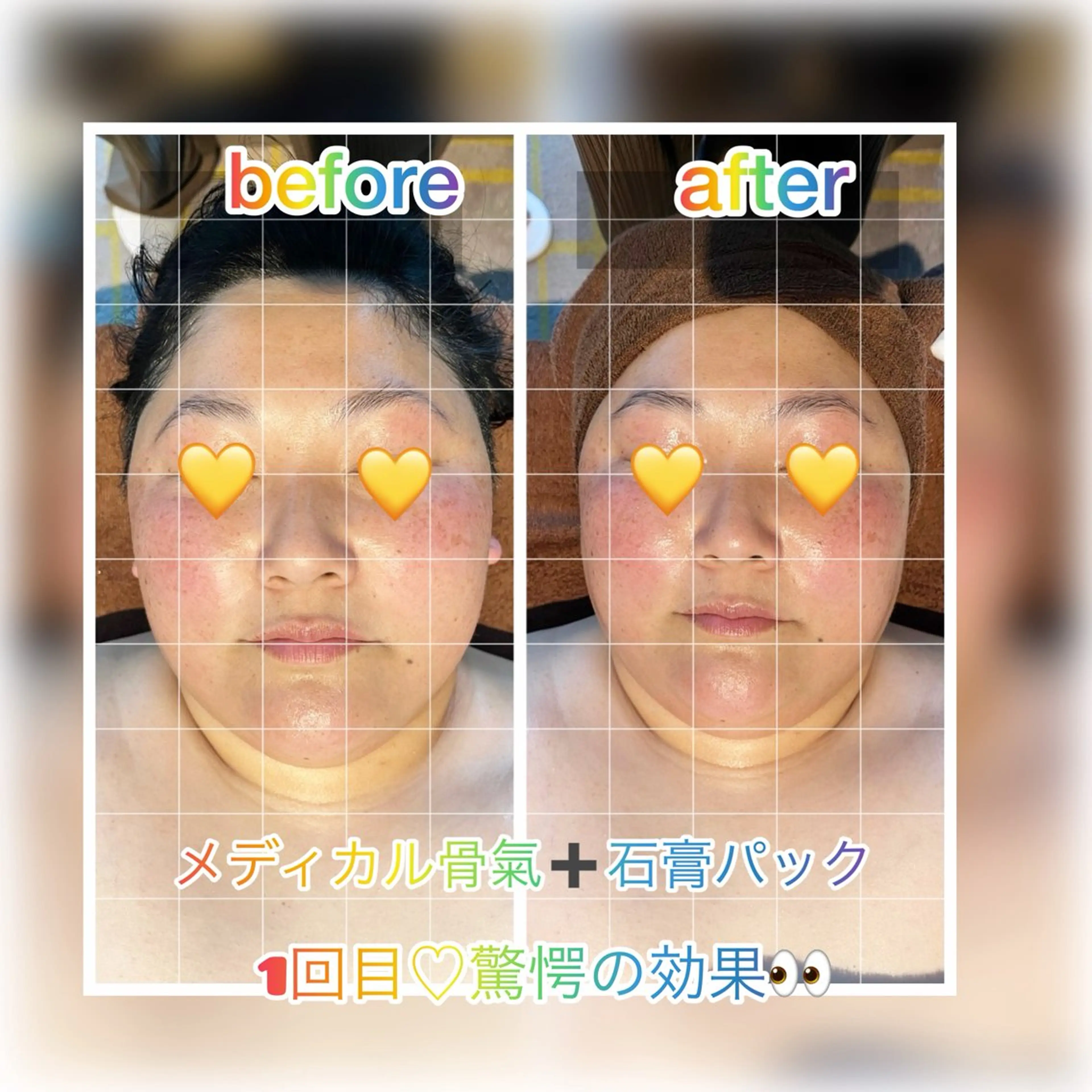 エステ リラク Tanpopo所属・メディカル骨氣サロン Tanpopoのエステ・リラクイメージ