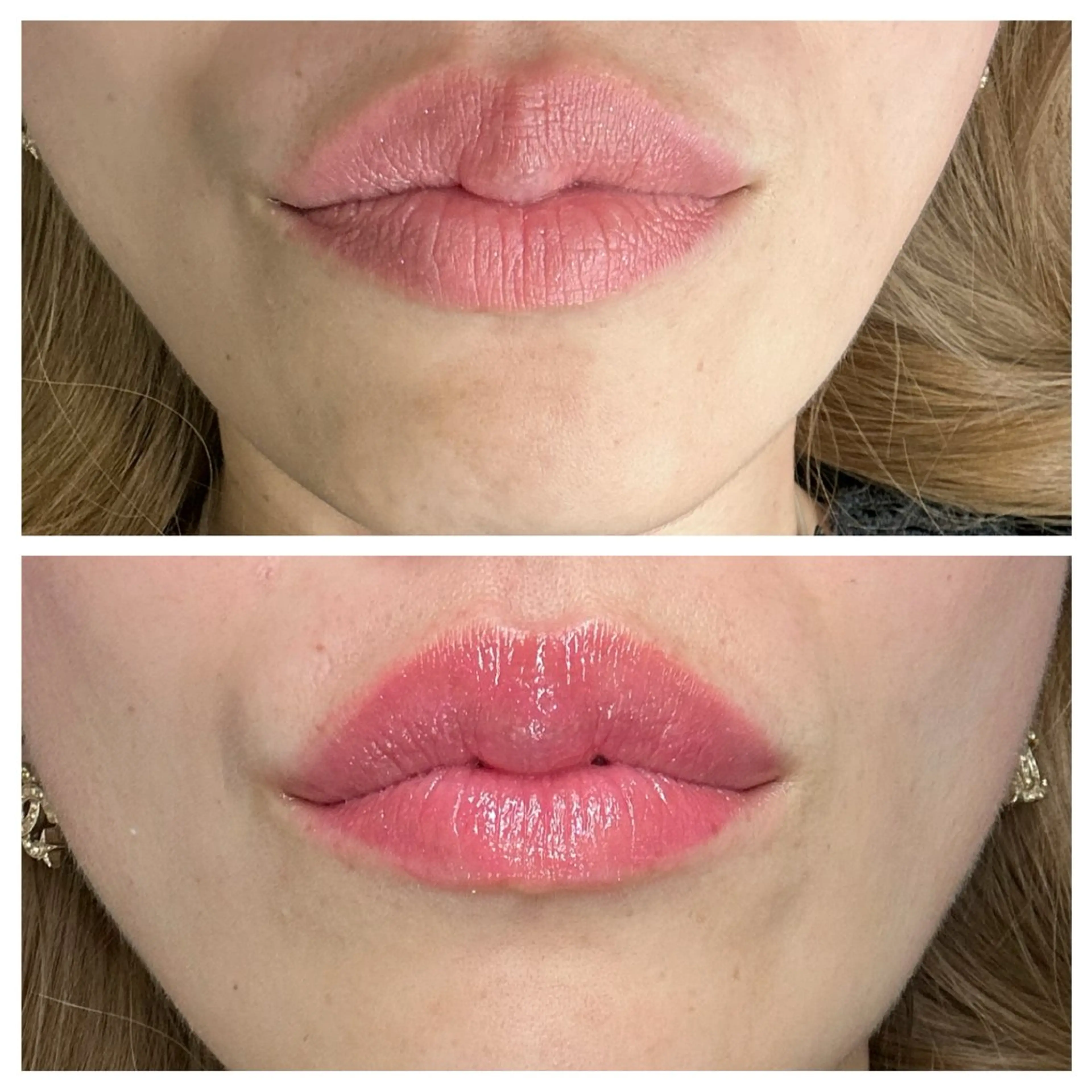 ララピンク💋メラニン除去リップの写真