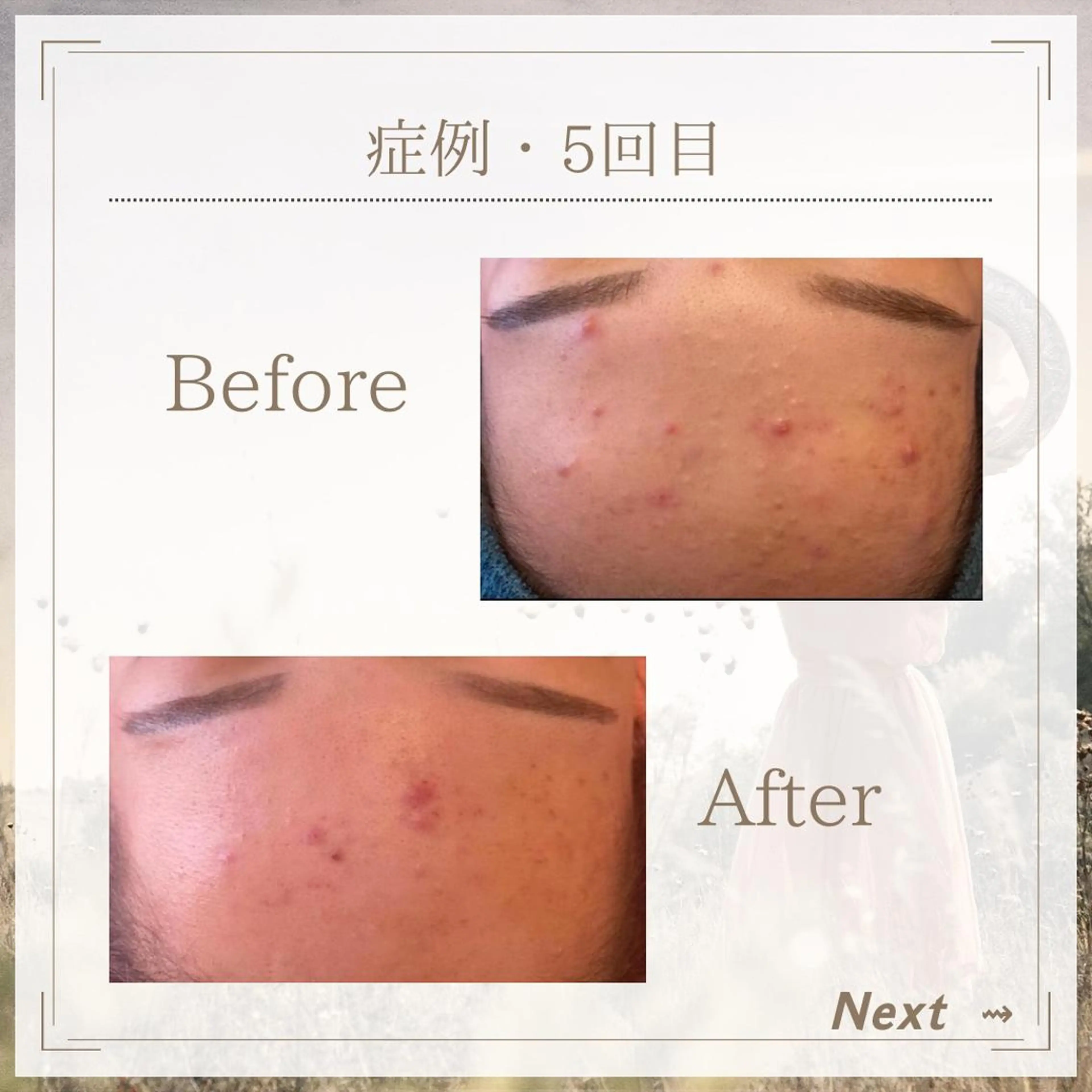 KARMA salonのネイルデザイン